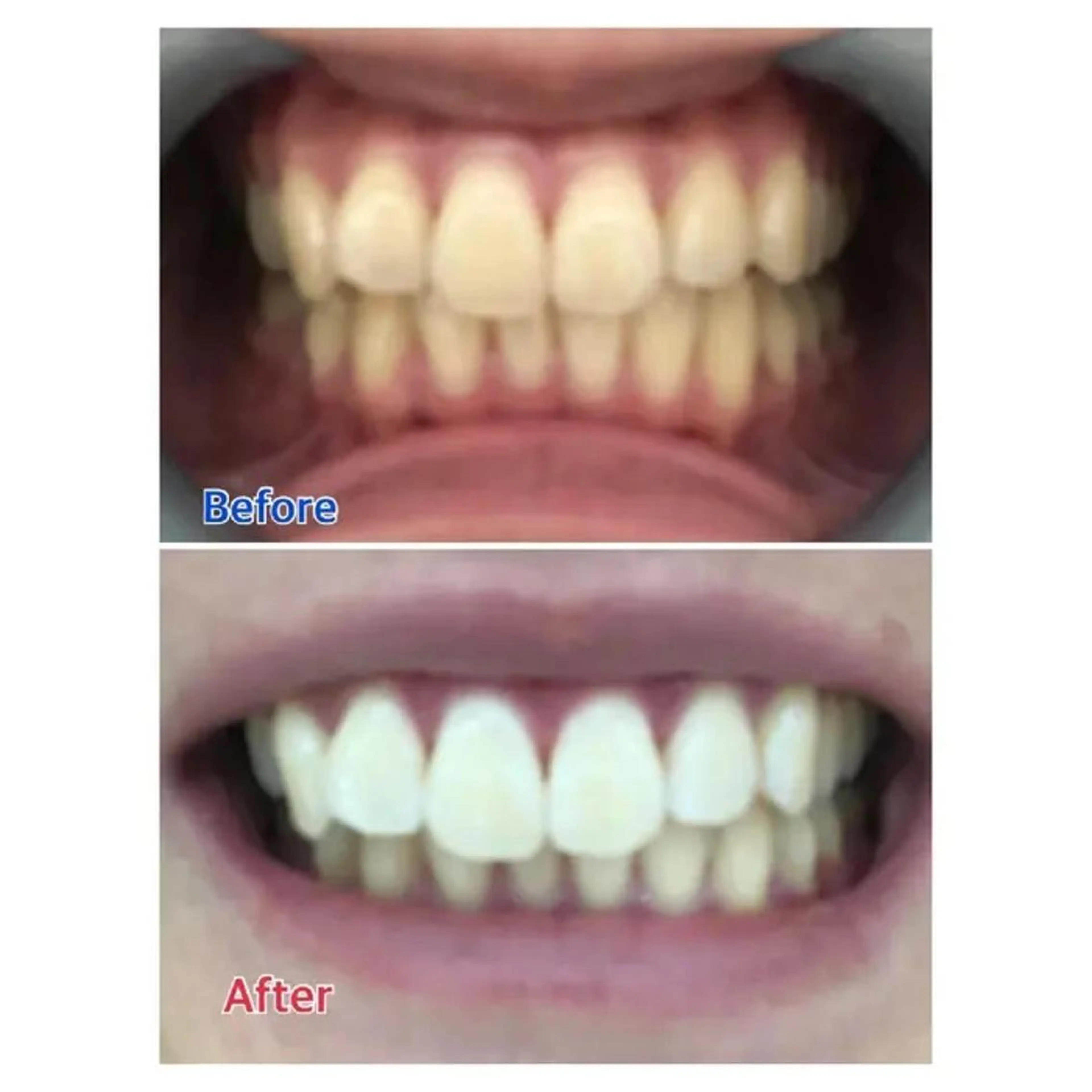 M渋谷 ホワイトニングのその他イメージ