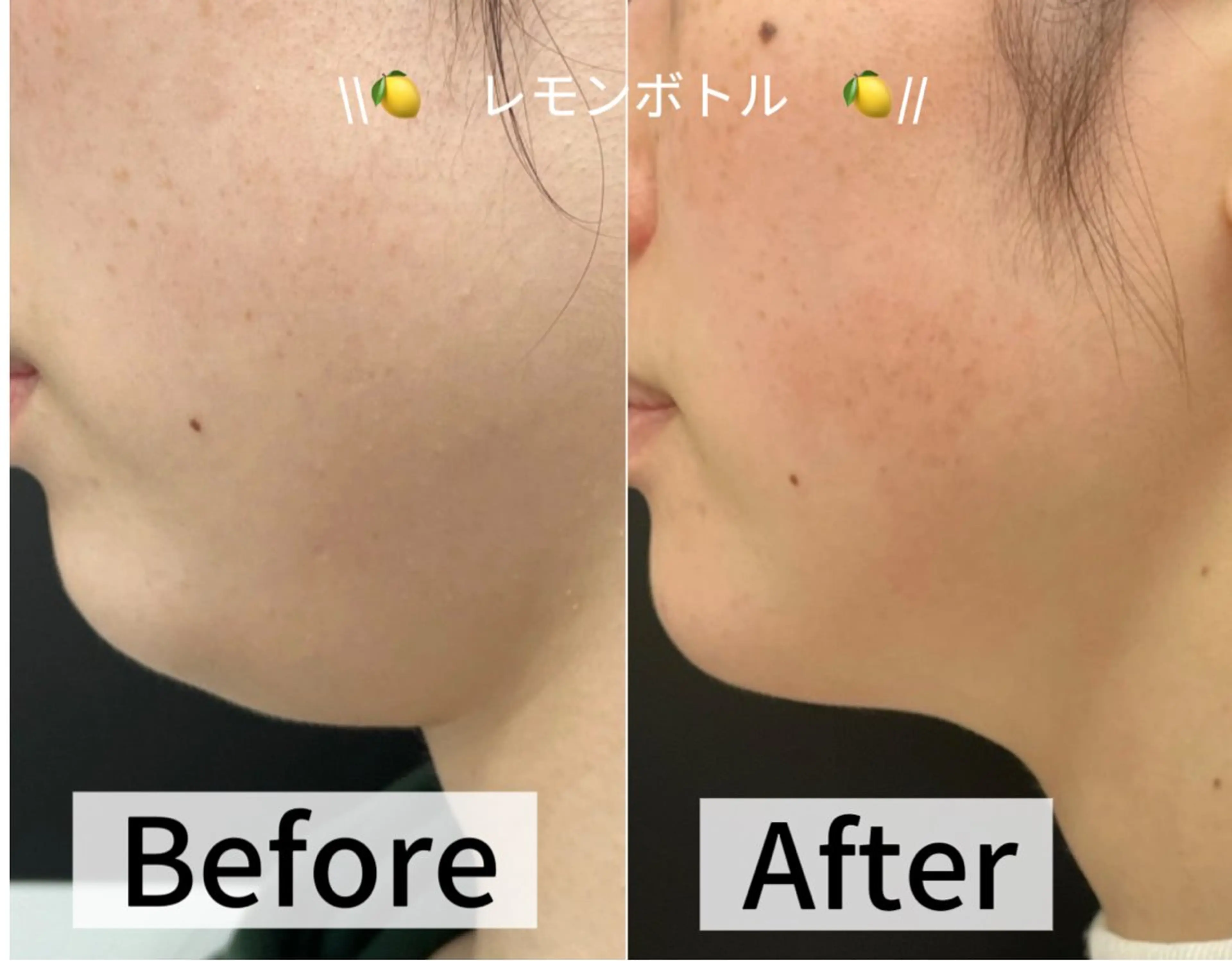 LUMINA ESTHのエステ・リラクイメージ