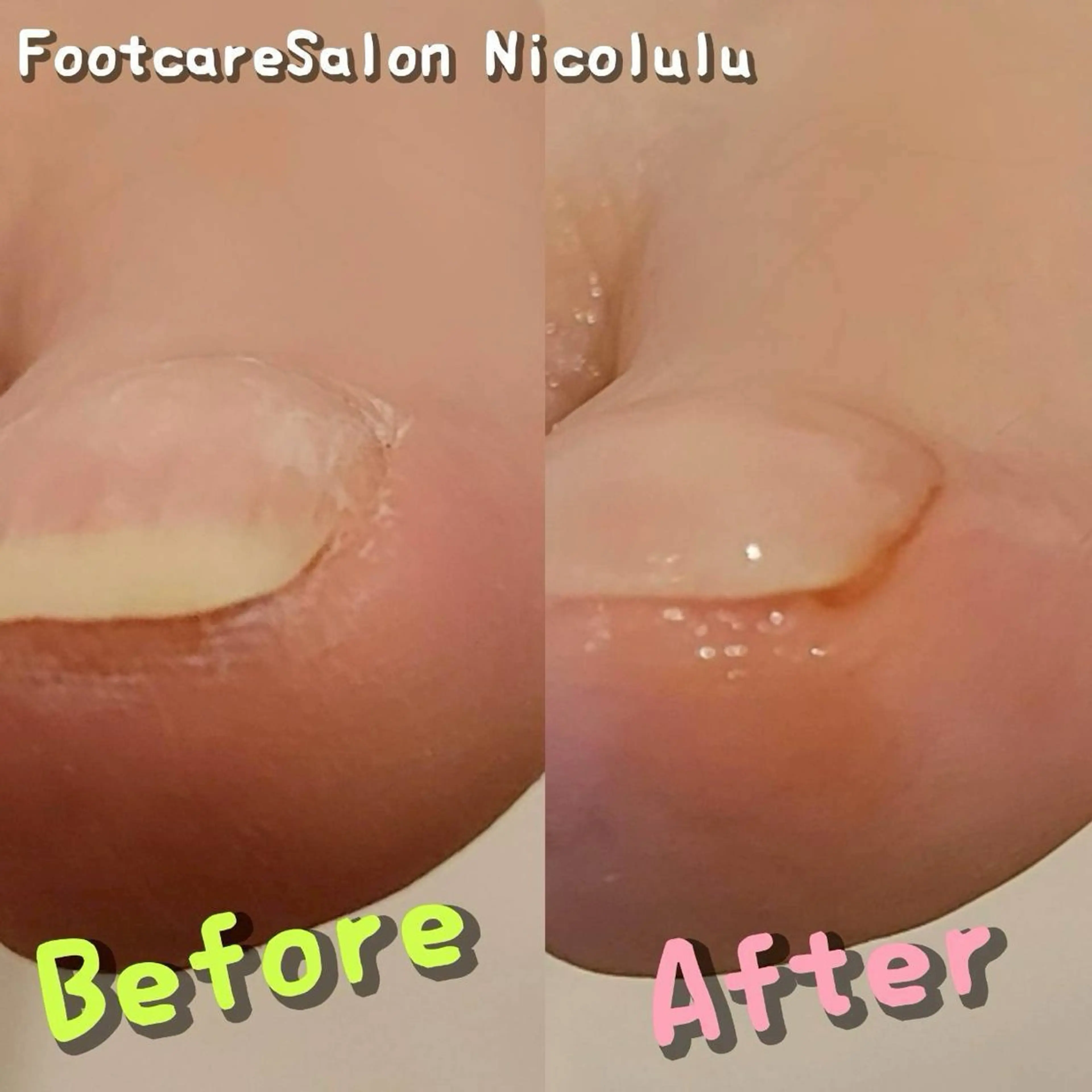 リラク 足トラブル専門 ニコルル金沢のエステ・リラクイメージ