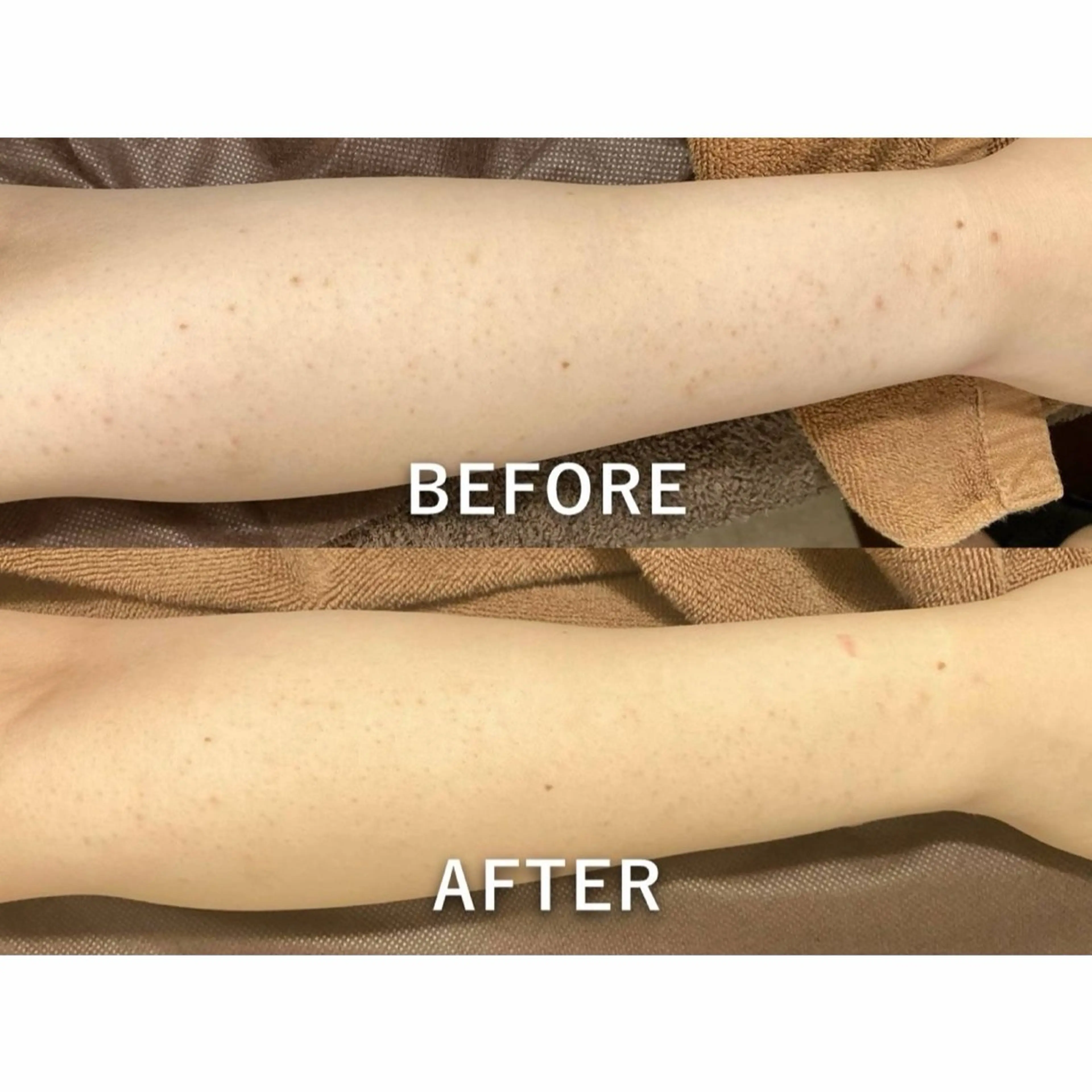 エステ 30minutes Rebeautyのエステ・リラクイメージ