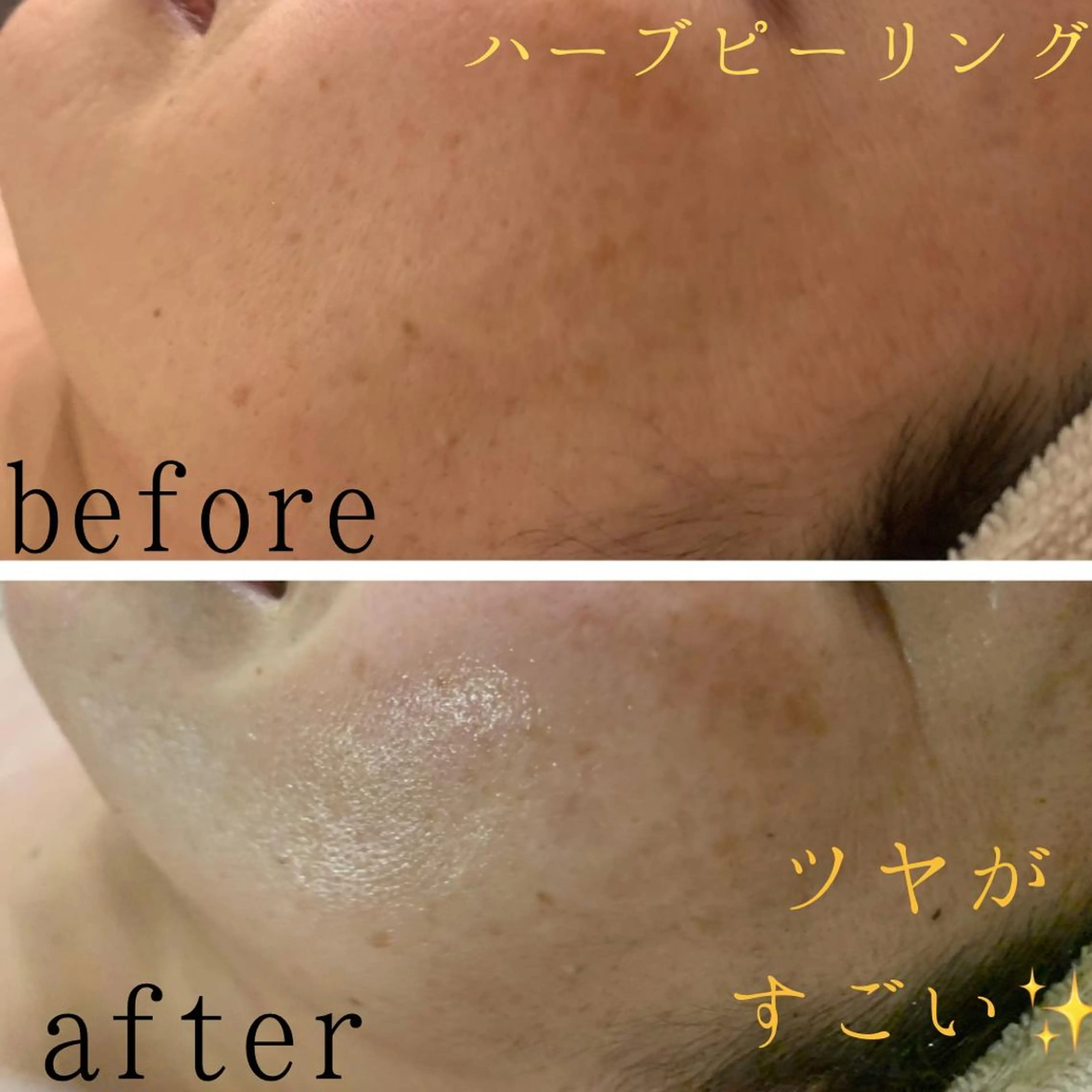 エステfreep takamoriのエステ・リラクイメージ