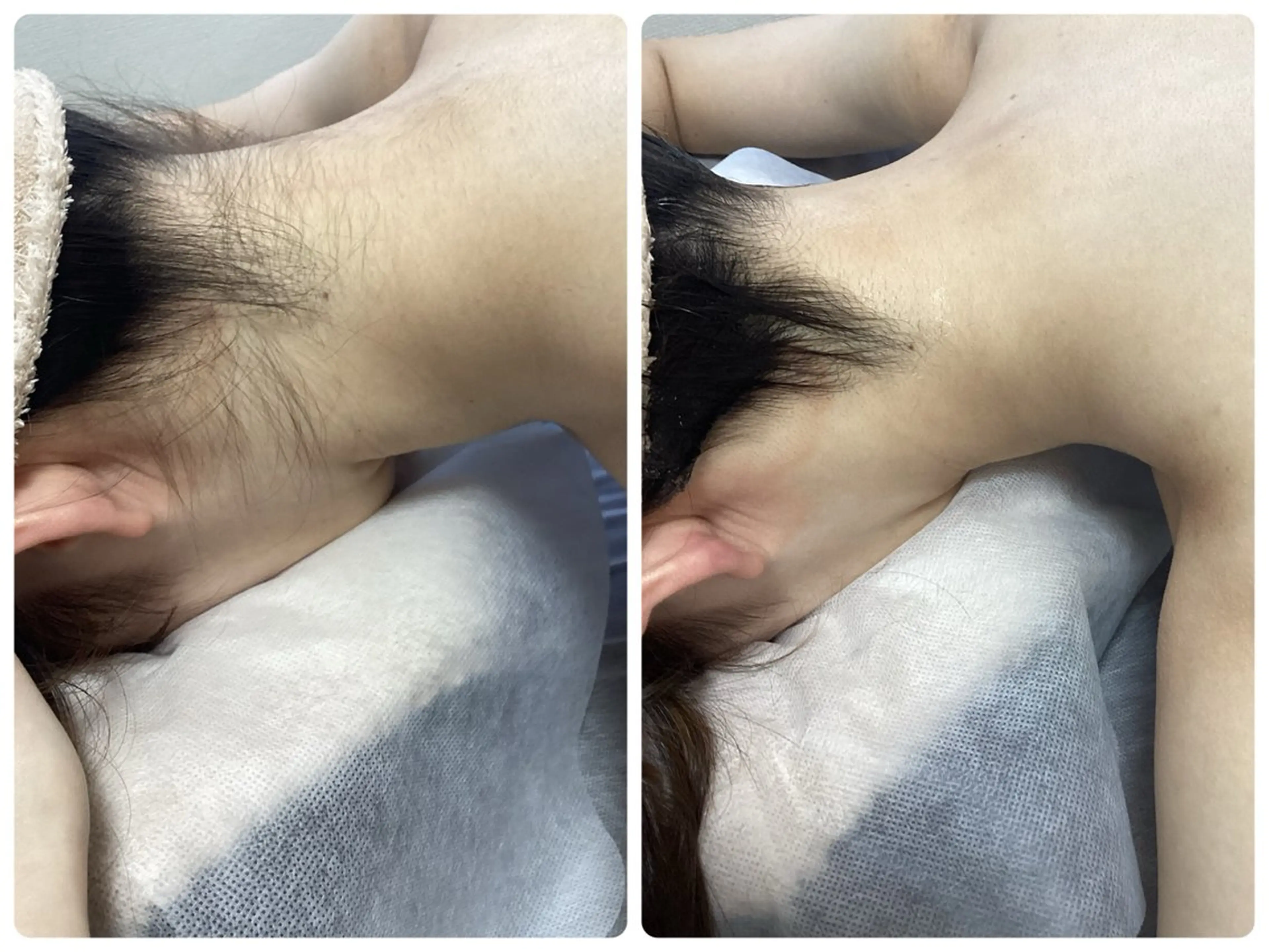 脱毛 脱毛専門減毛サロン LULU.tokyoのエステ・リラクイメージ