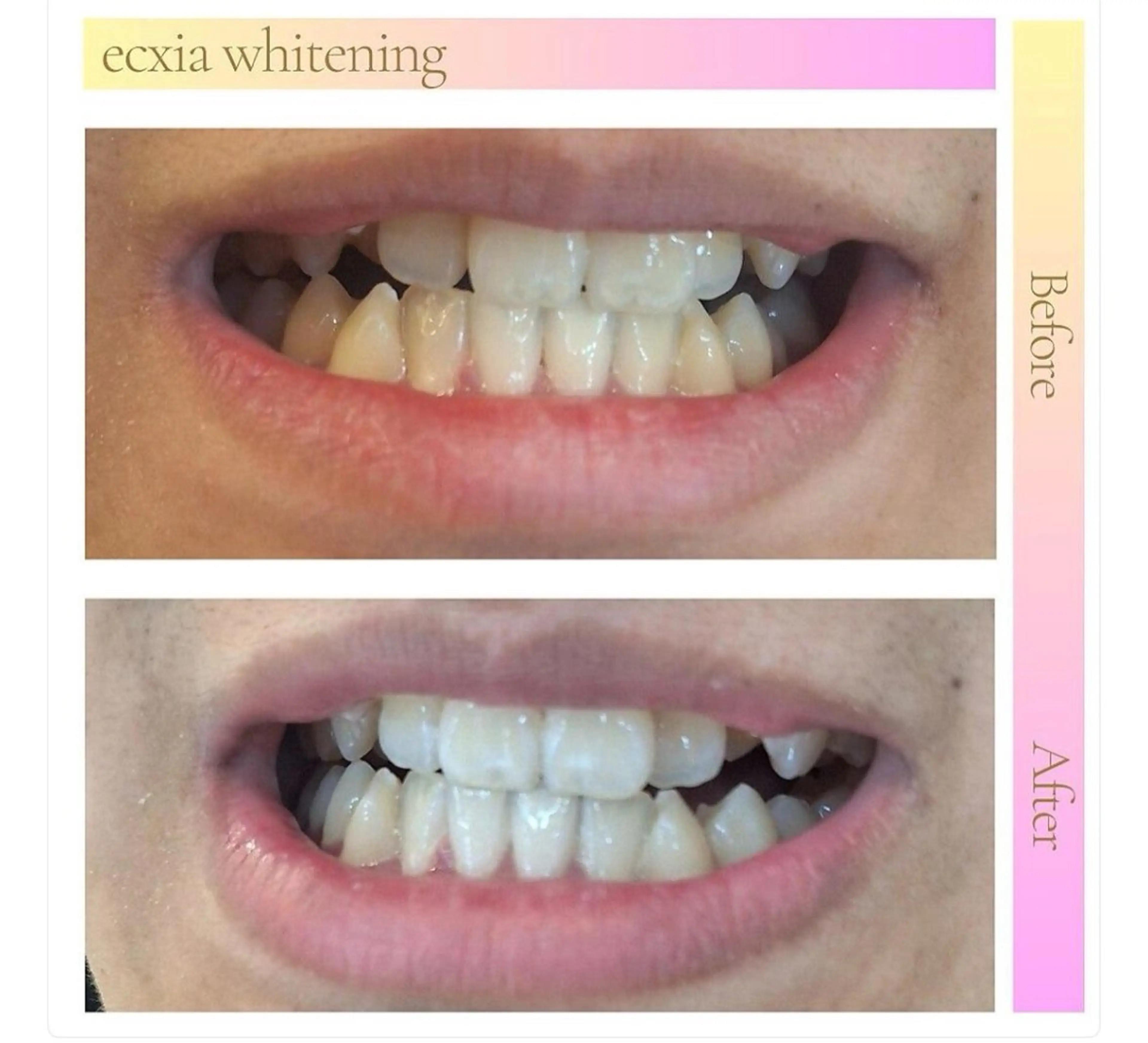 ecxia新白河店 ゆきのその他イメージ