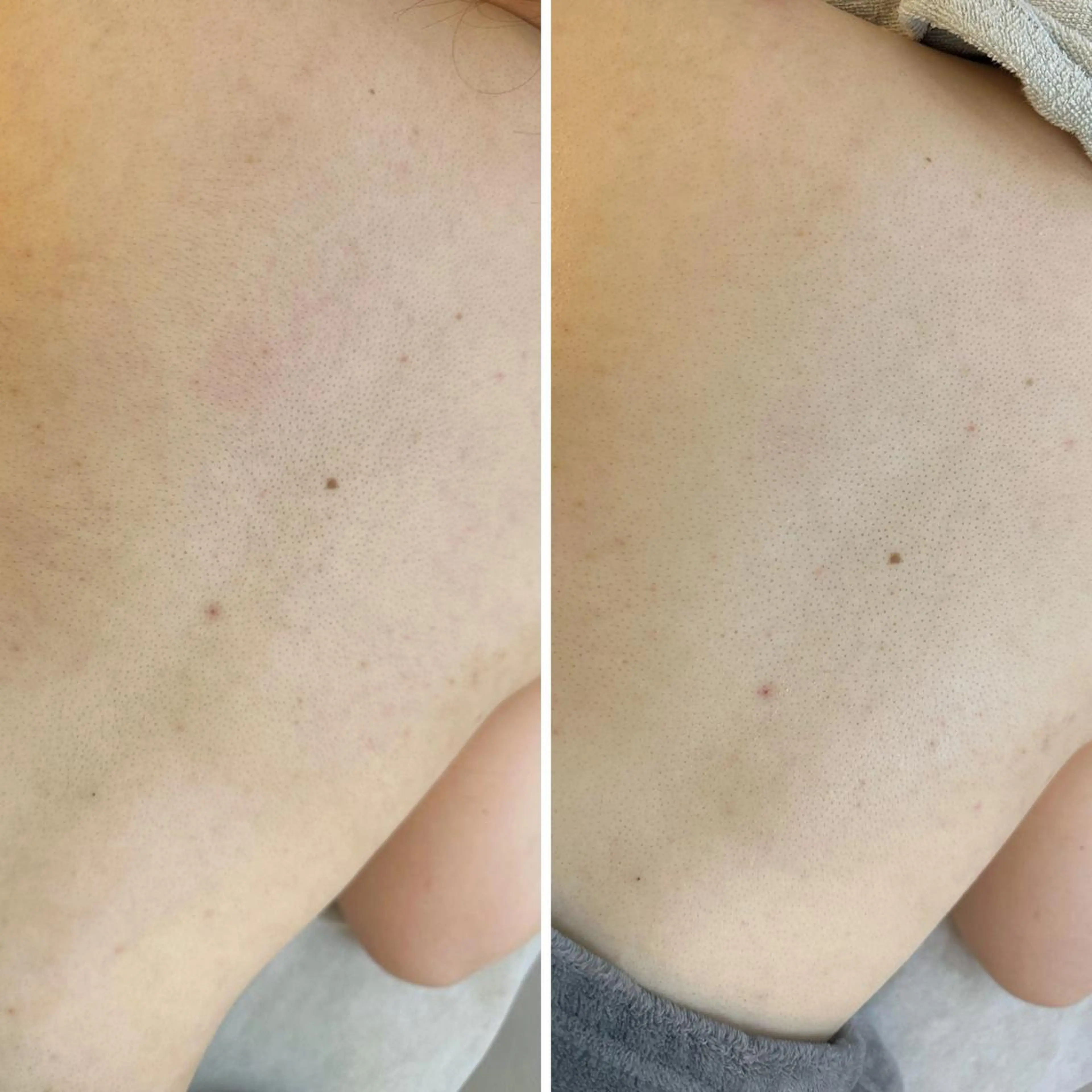 うなじ脱毛/美肌脱毛 LABELのエステ・リラクイメージ