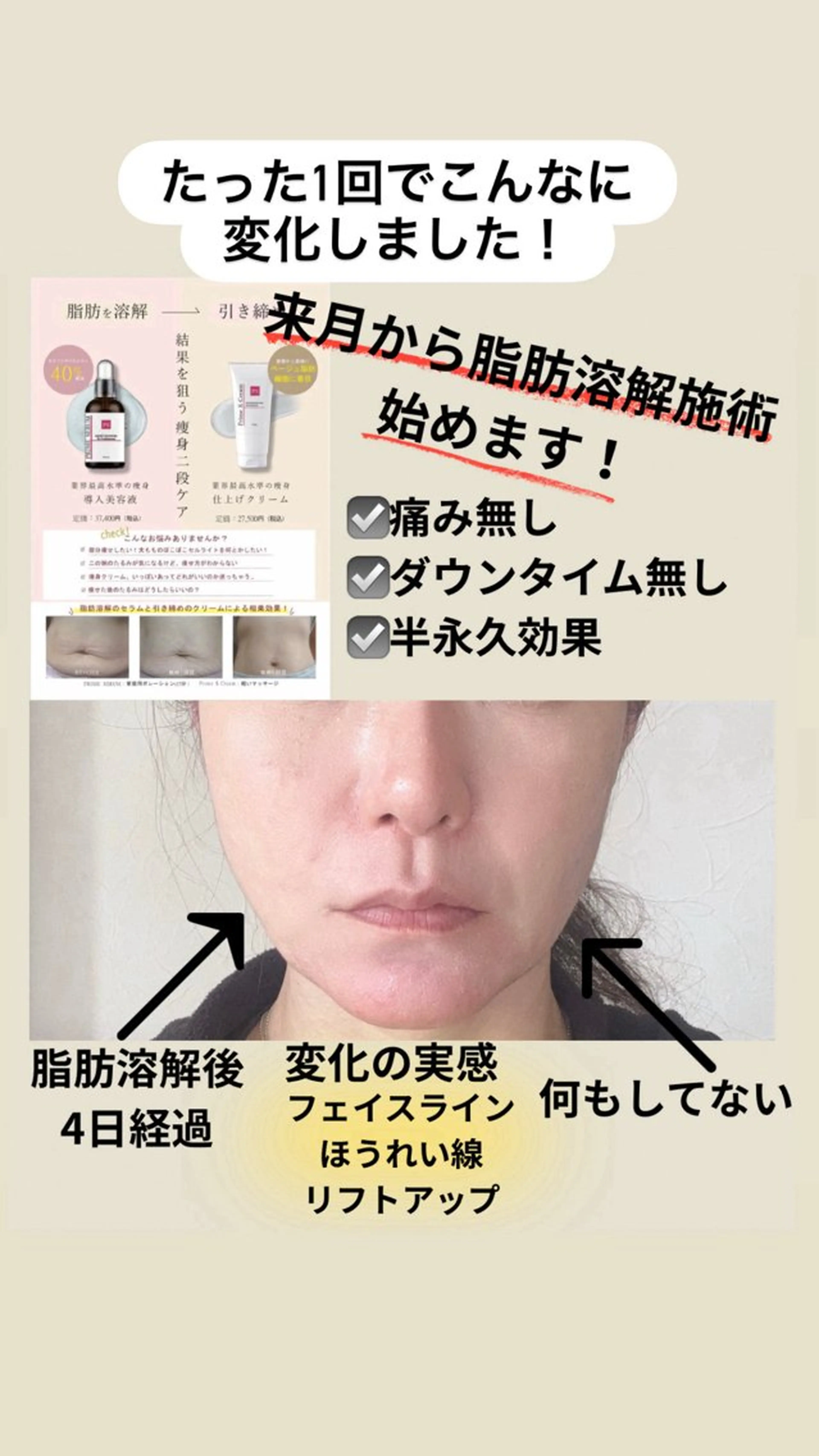 (初回)小顔フェイシャル！二重アゴ撃退メニュー！の写真