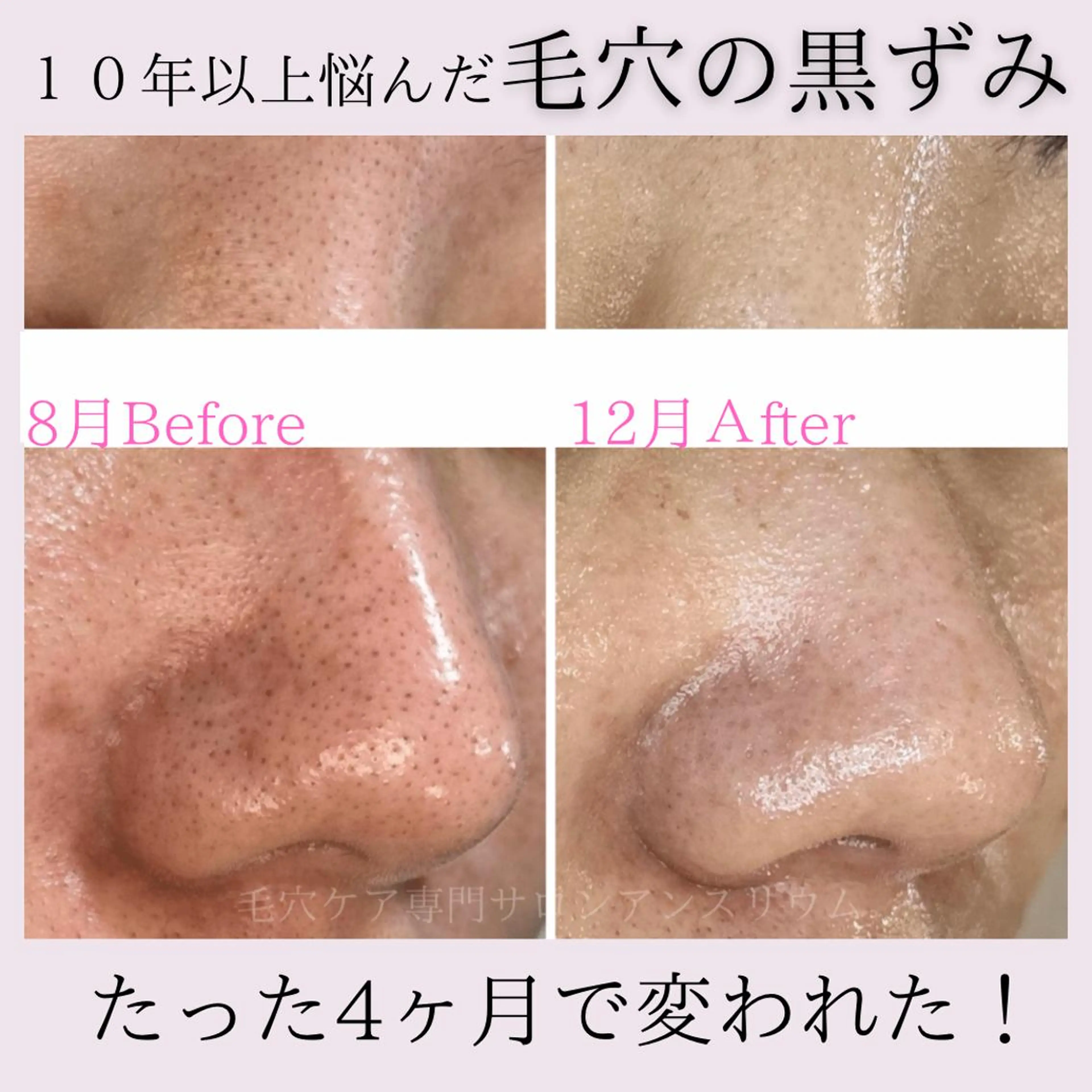 茨城土浦 つくば毛穴 ケア専門サロンのエステ・リラクイメージ