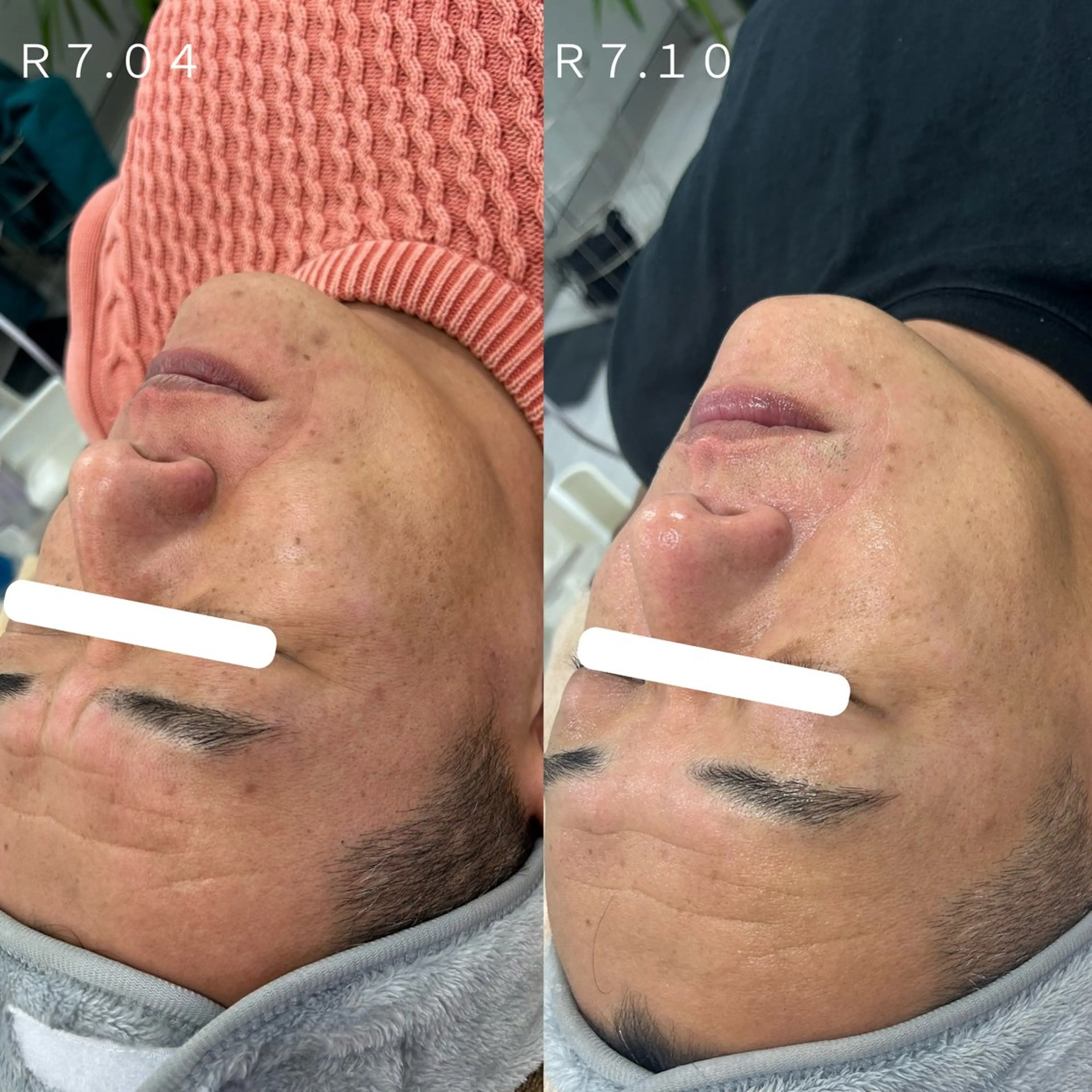 エステ Venus所属・エステサロン Venusのその他イメージ