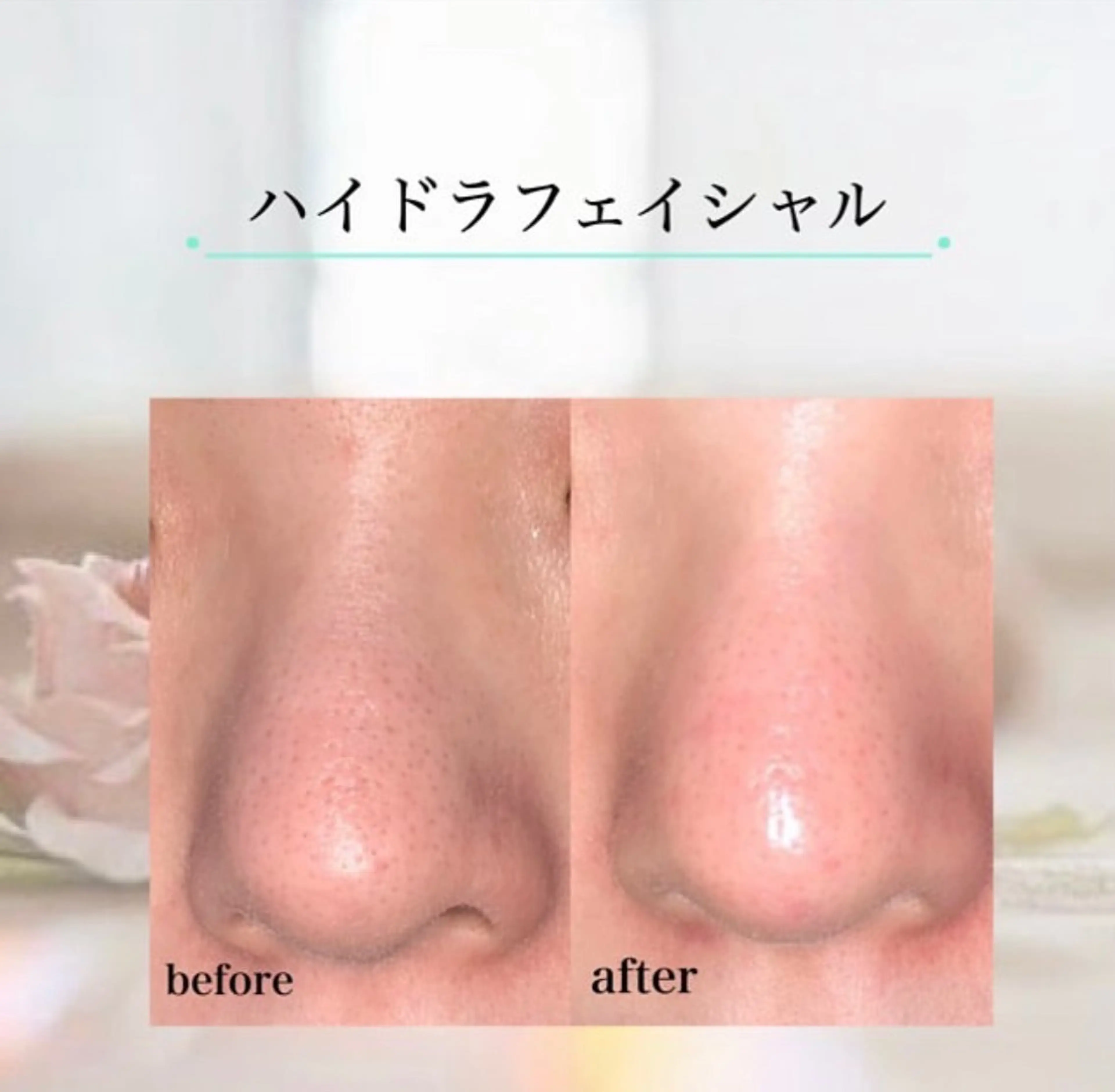 【都度払い専門店】 エステサロARTI,のエステ・リラクイメージ