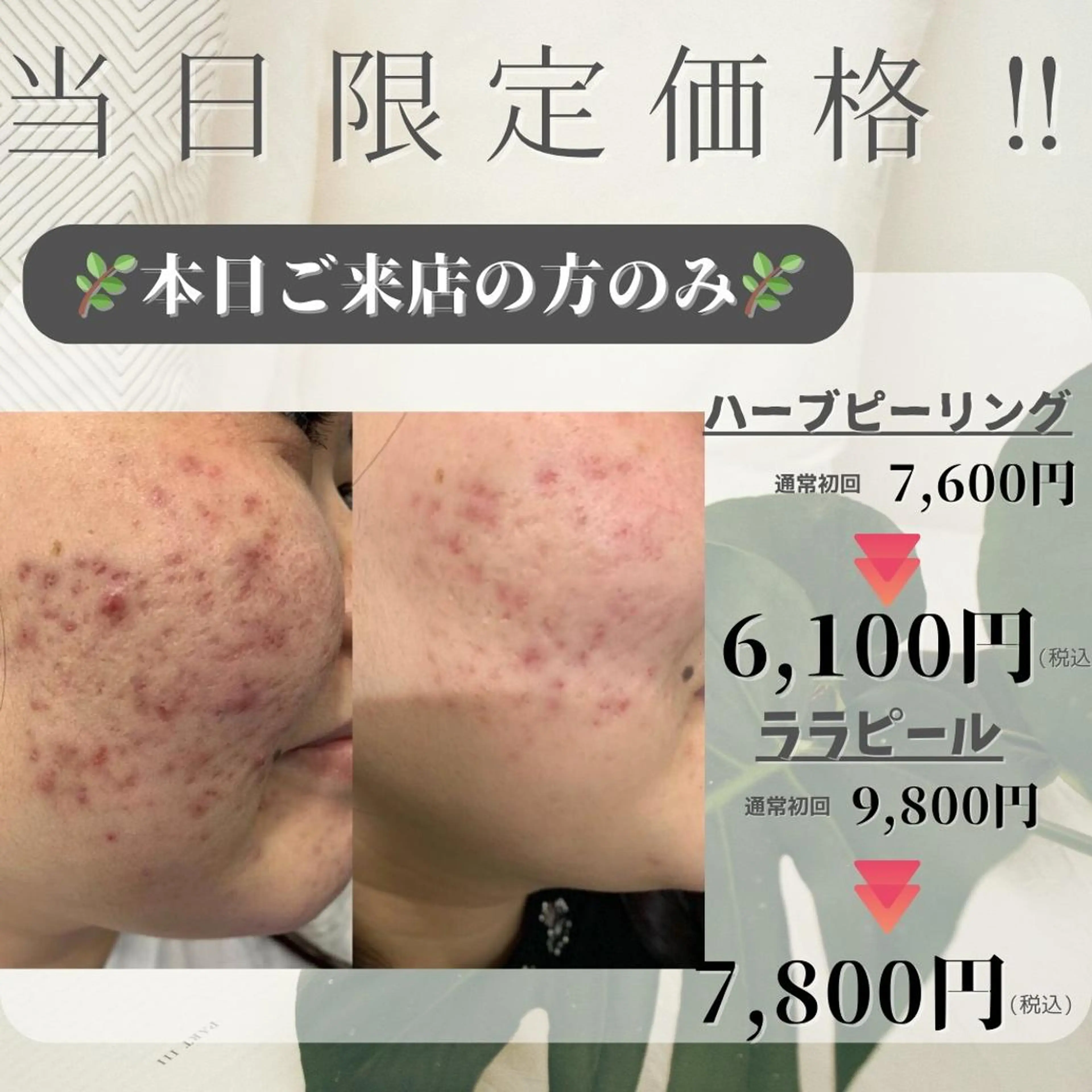 肌管理ララピール RAVIOS渡邉のエステ・リラクイメージ