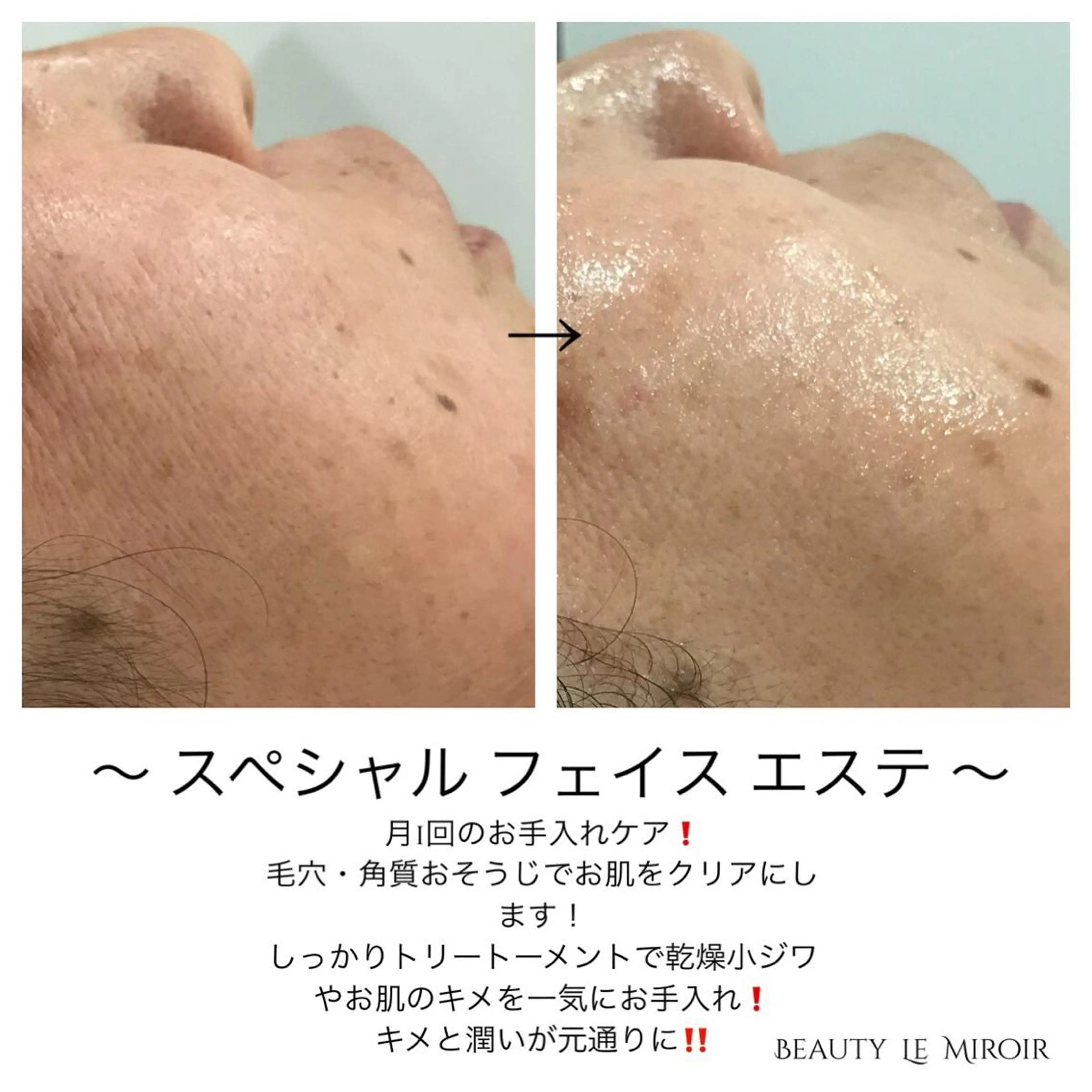 ビューティー ミロワールのエステ・リラクイメージ