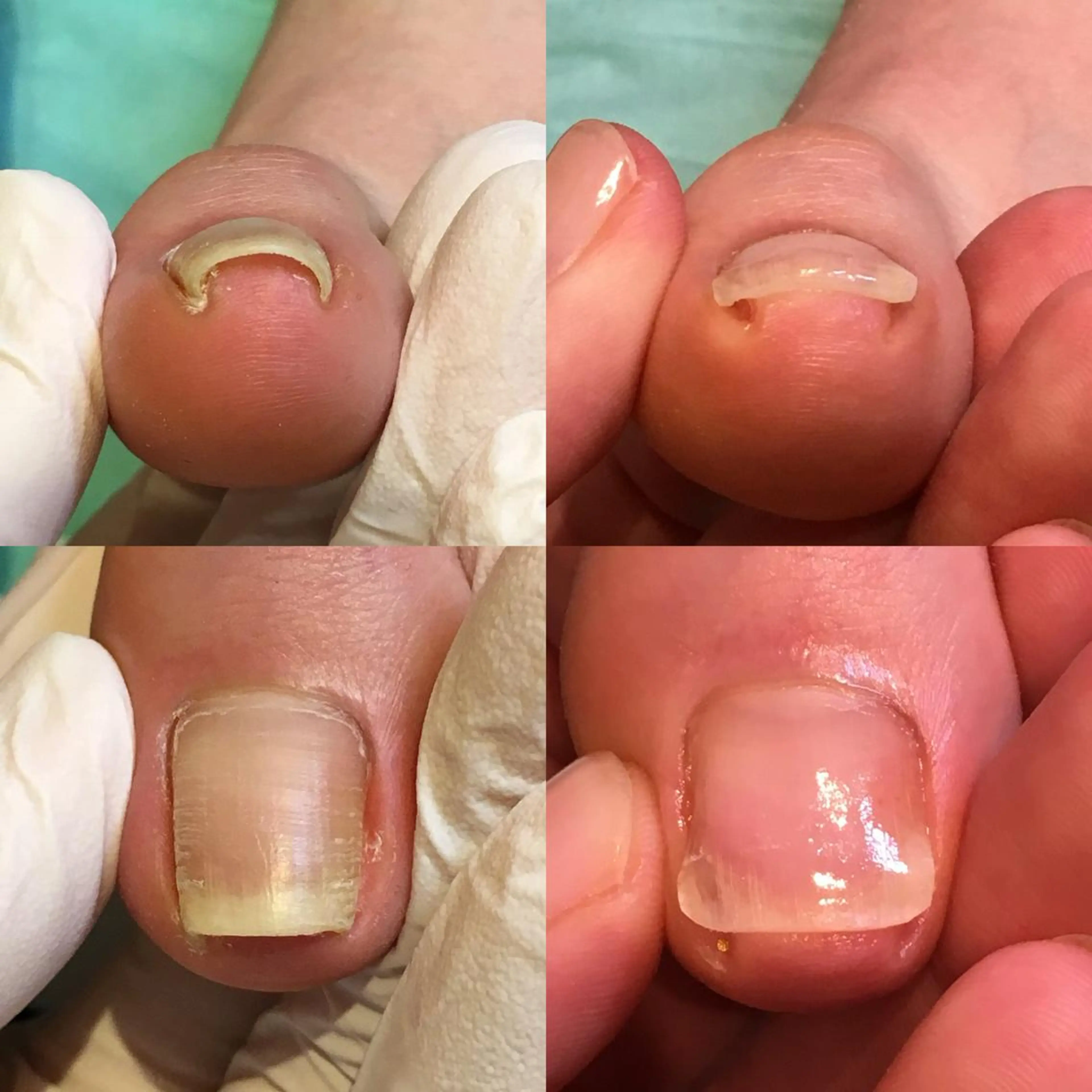 ネイル 東京巻き爪アカデミー所属・東京巻き爪 アカデミーのエステ・リラクイメージ