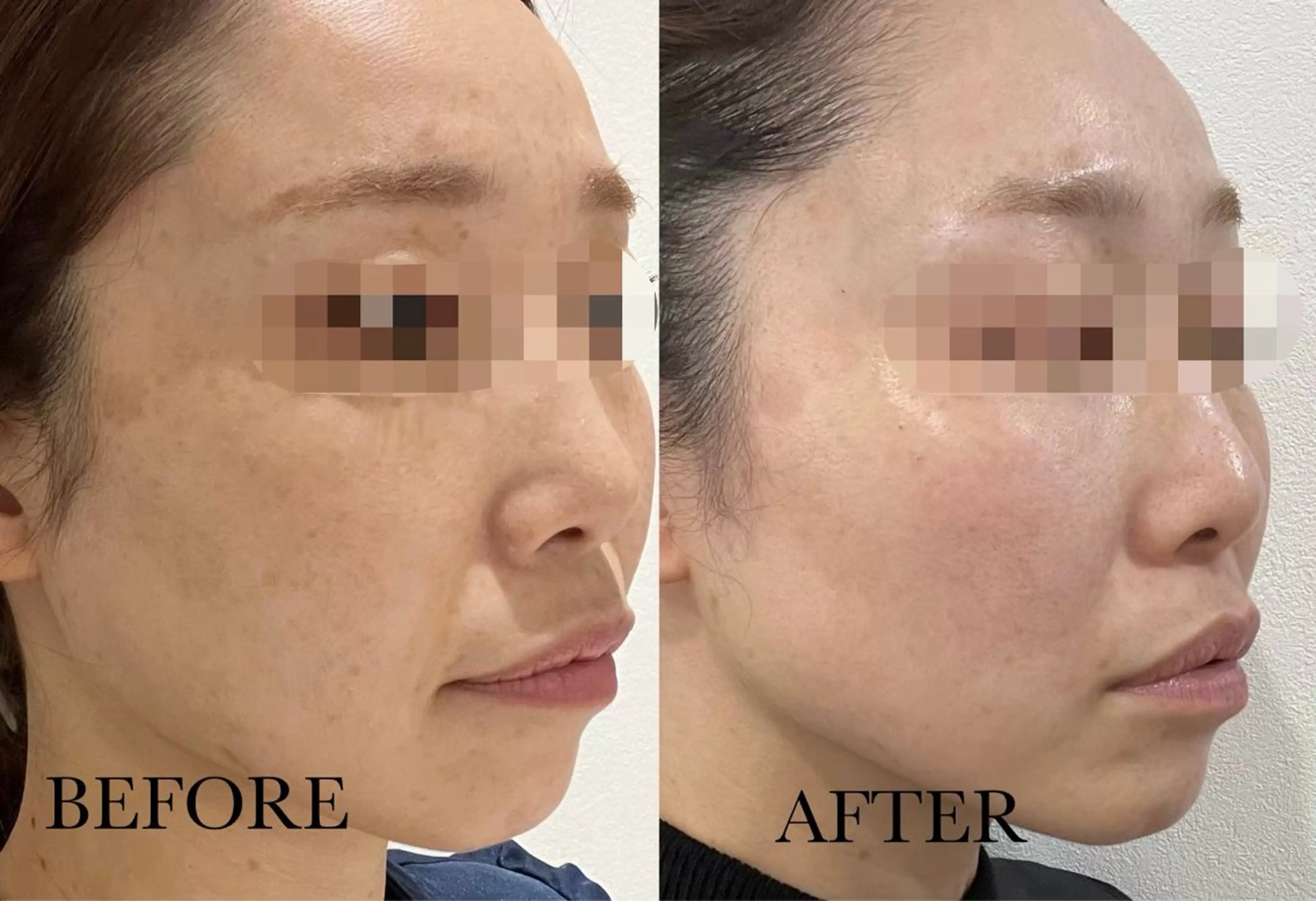 Sii センター北のエステ・リラクイメージ