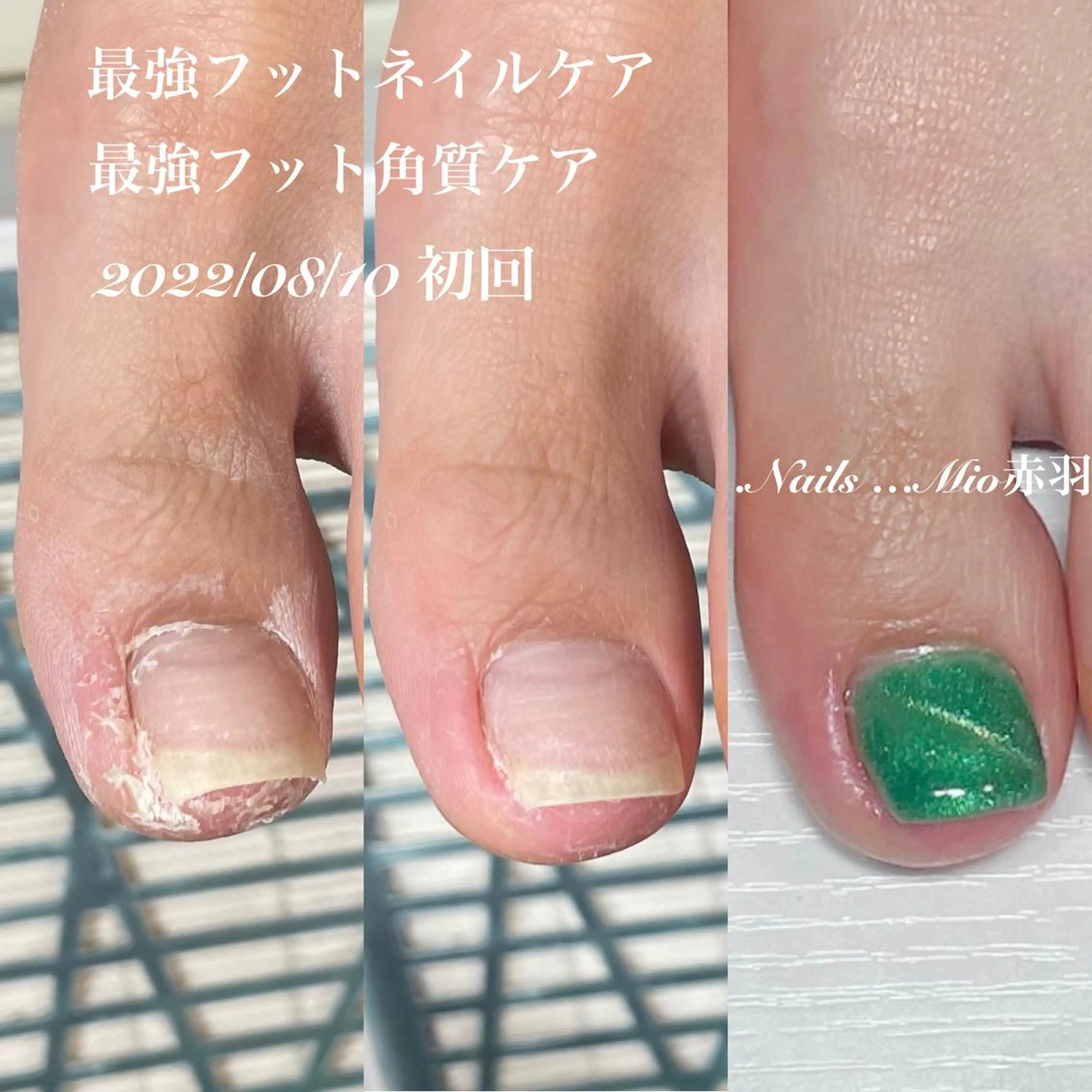 ネイル フットネイル .Nails Mio 赤羽西ネイルサロンのネイルデザイン