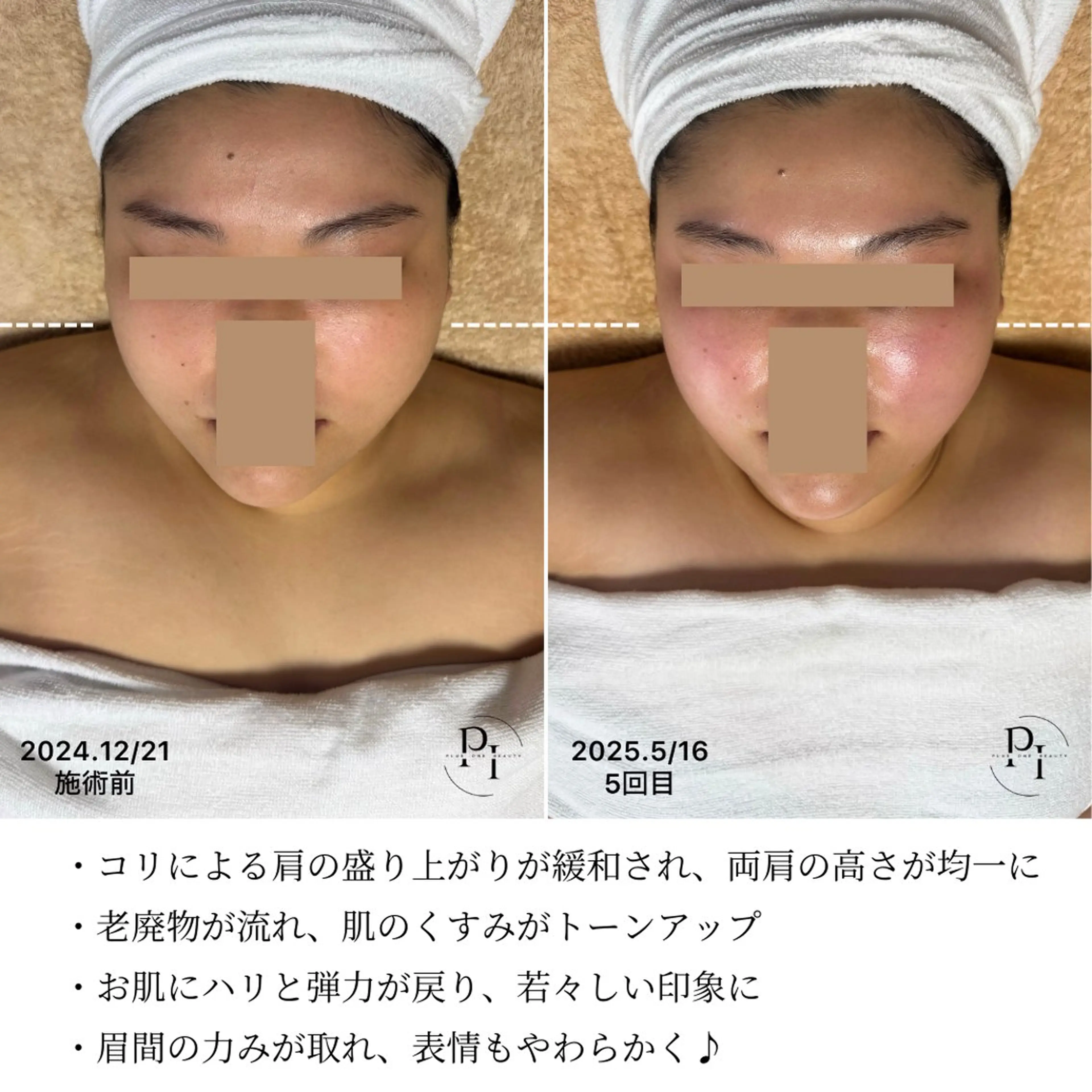 Plus One Beauty所属・【新大阪】痩身/小顔 美肌フェイシャルのエステ・リラクイメージ