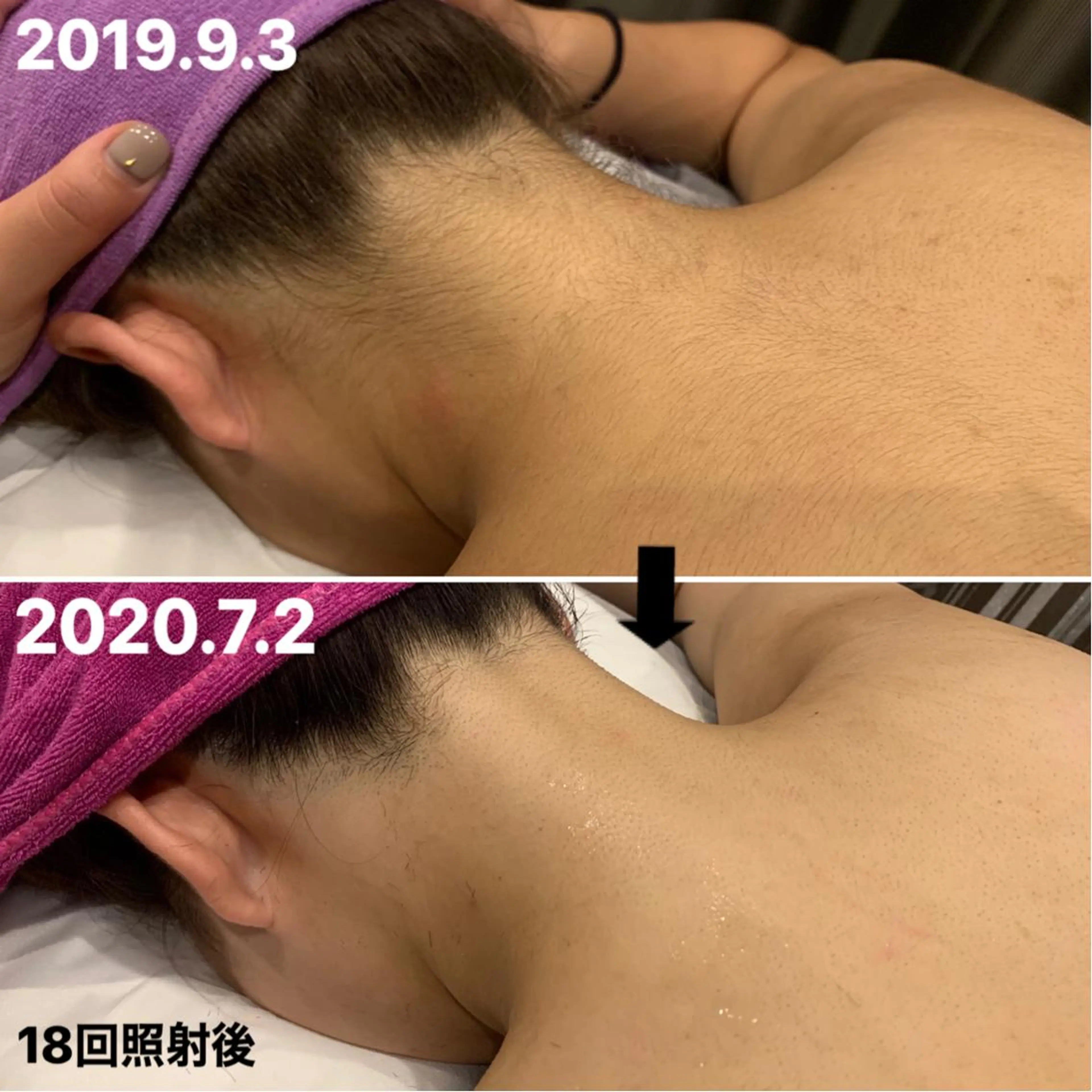 脱毛＆エステサロン【アンリミット】所属・森谷 莉美のエステ・リラクイメージ