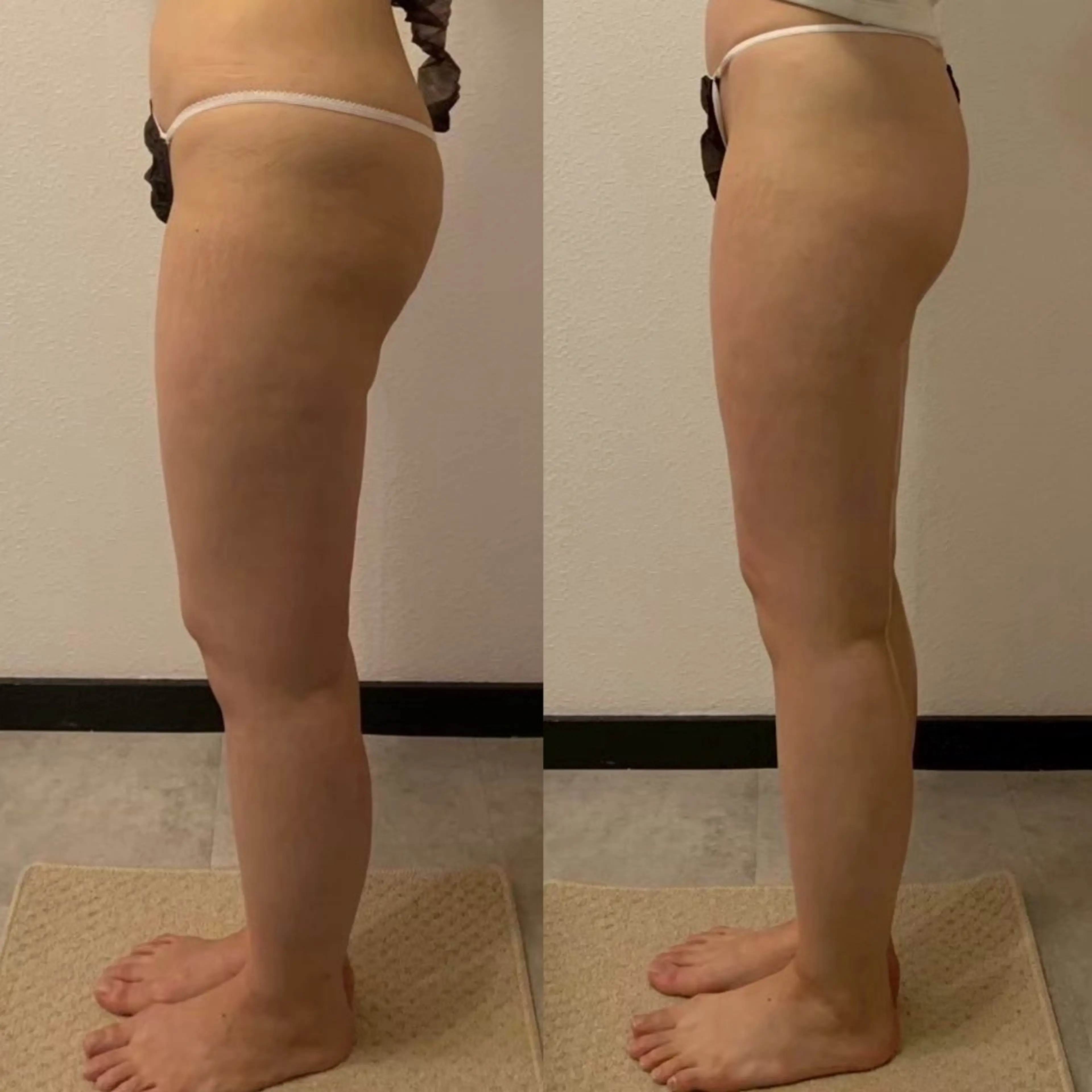エステ 体重よりも見た目を 変える脚痩せサロンのエステ・リラクイメージ