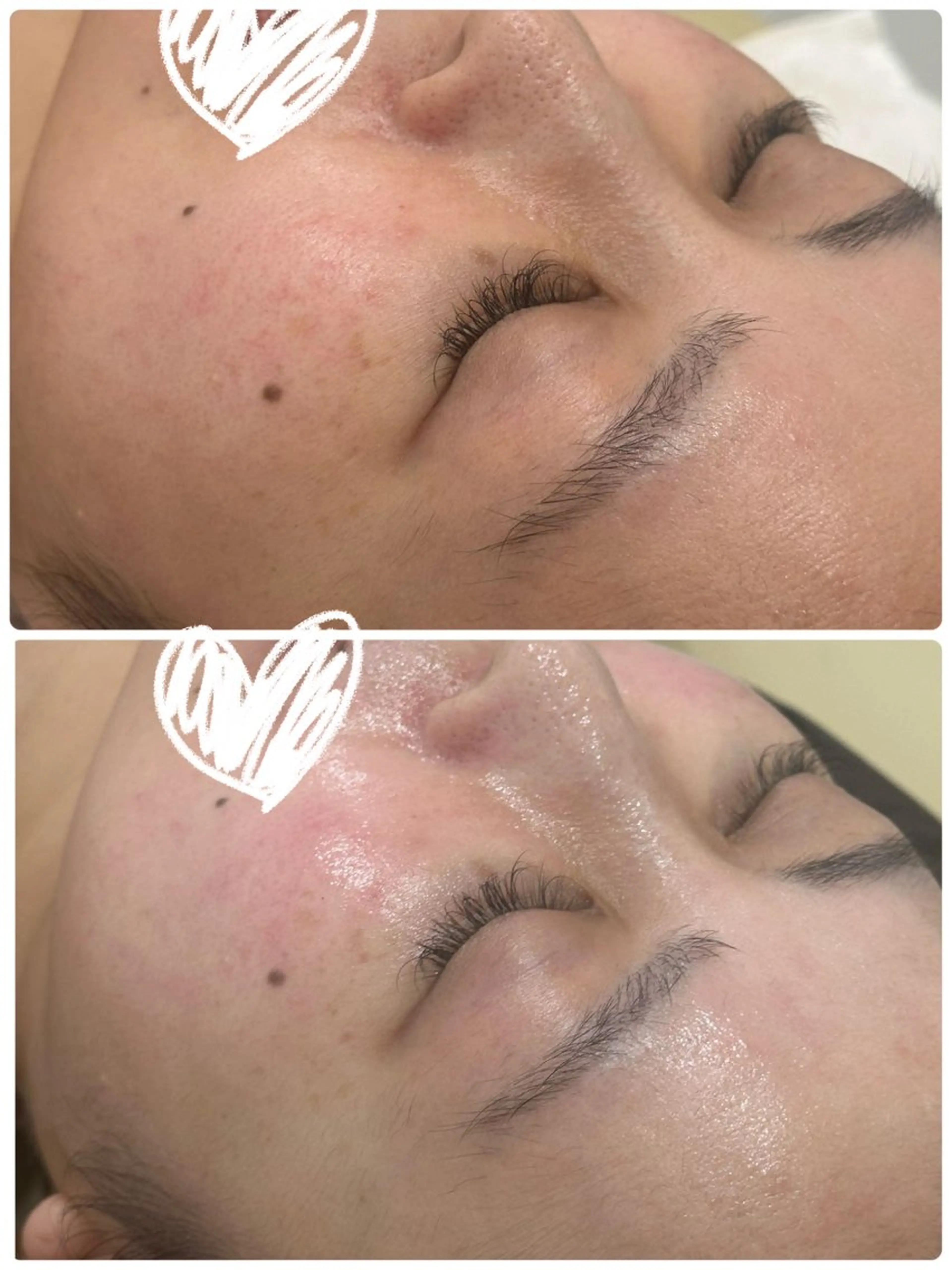 エステ リラク 美容鍼灸サロン YOSHINOのエステ・リラクイメージ