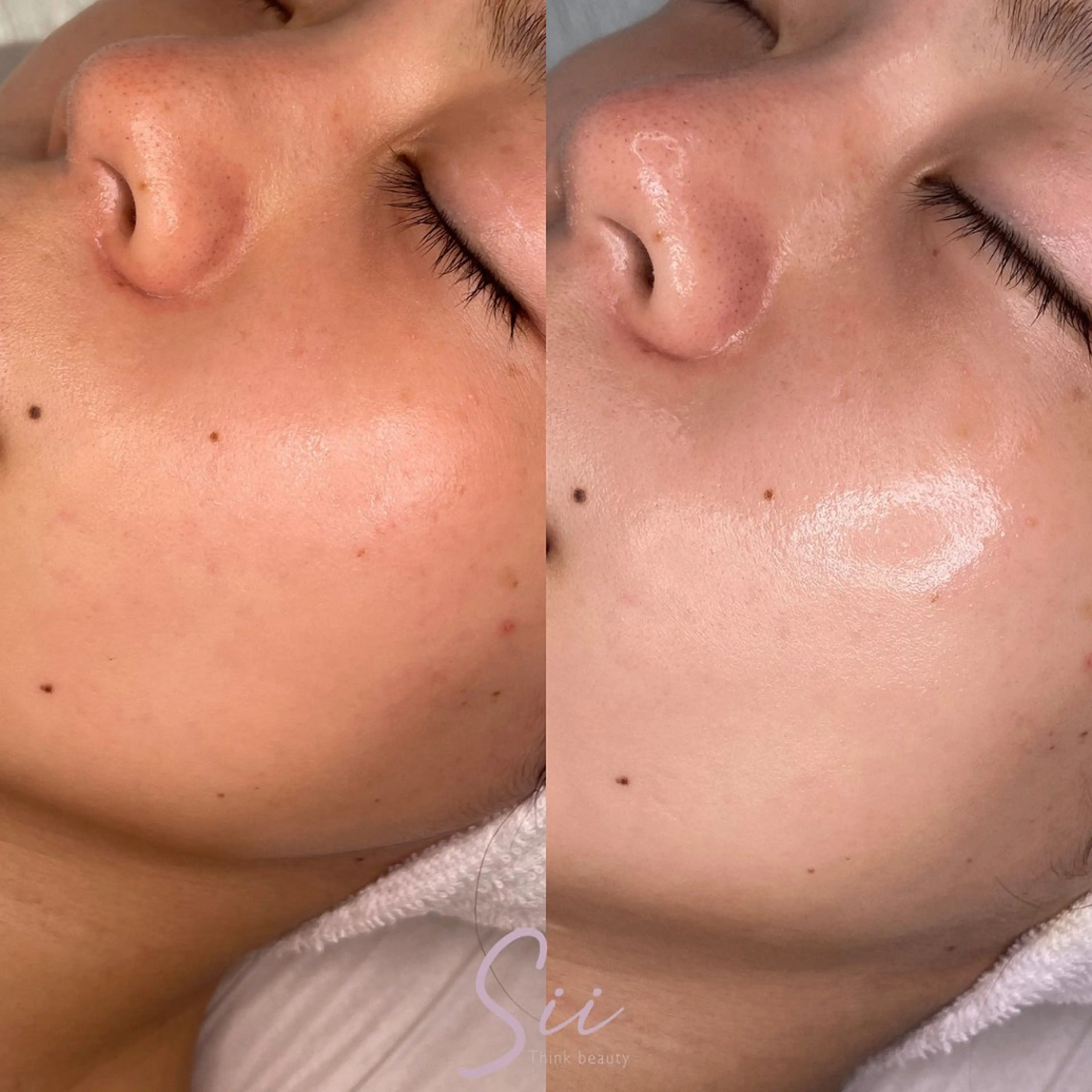 beauty salon Clochette所属・clochette misakoのエステ・リラクイメージ