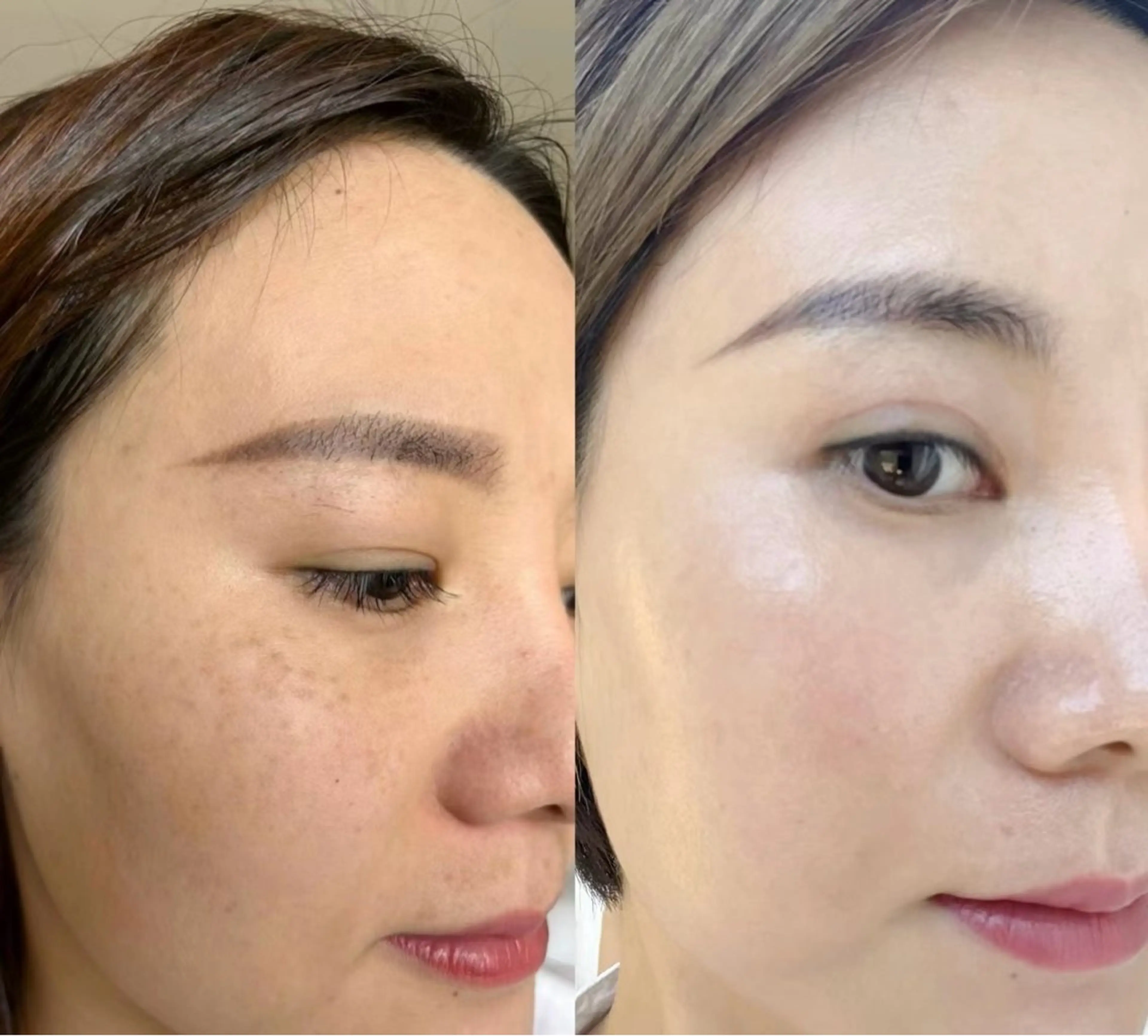 ネイル エステ aliaハイフ&水光ジェットサロン所属・aliaハーブ水光店 エステティシャン募集のエステ・リラクイメージ