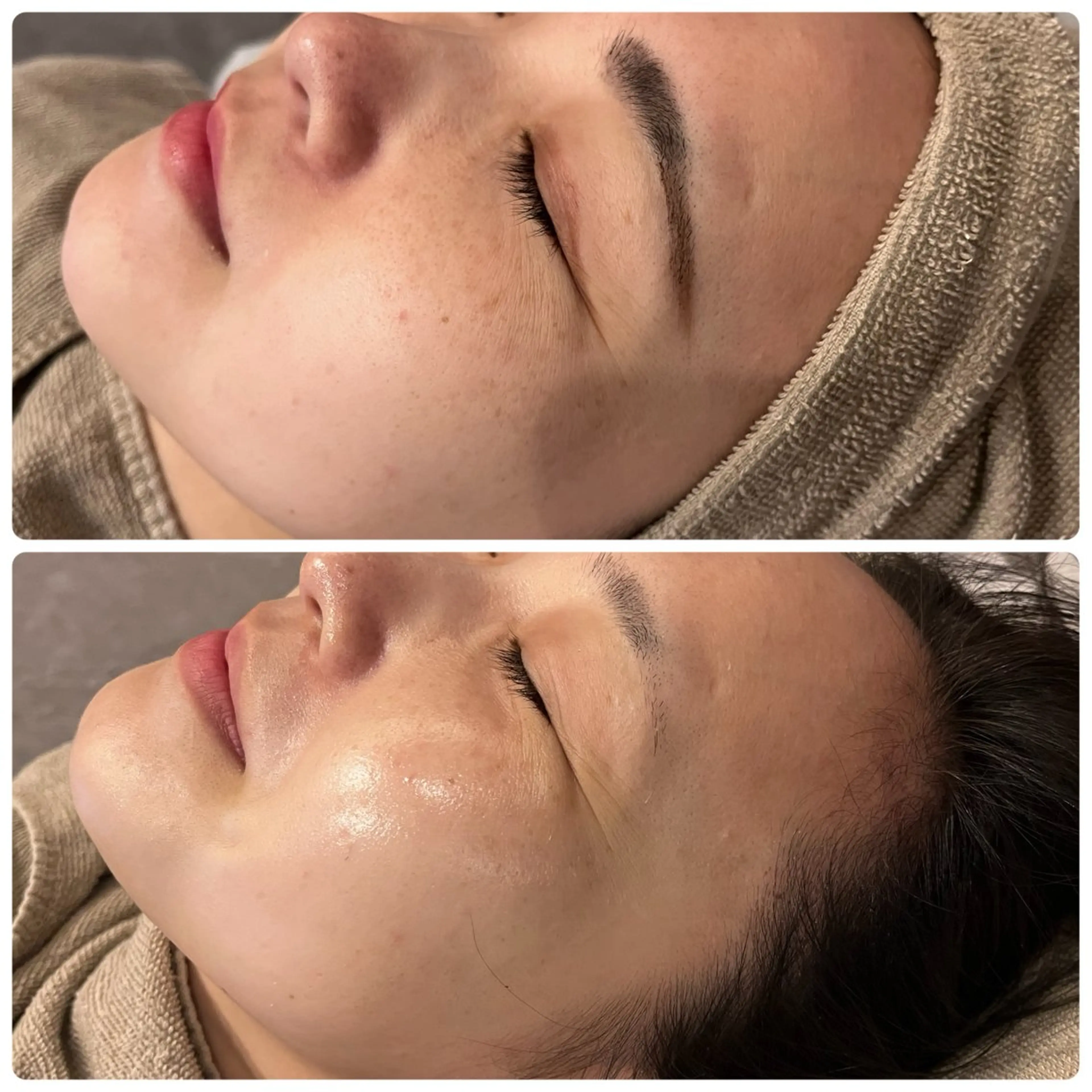 その他 yellow💛【 脱毛&フェイシャル】のエステ・リラクイメージ