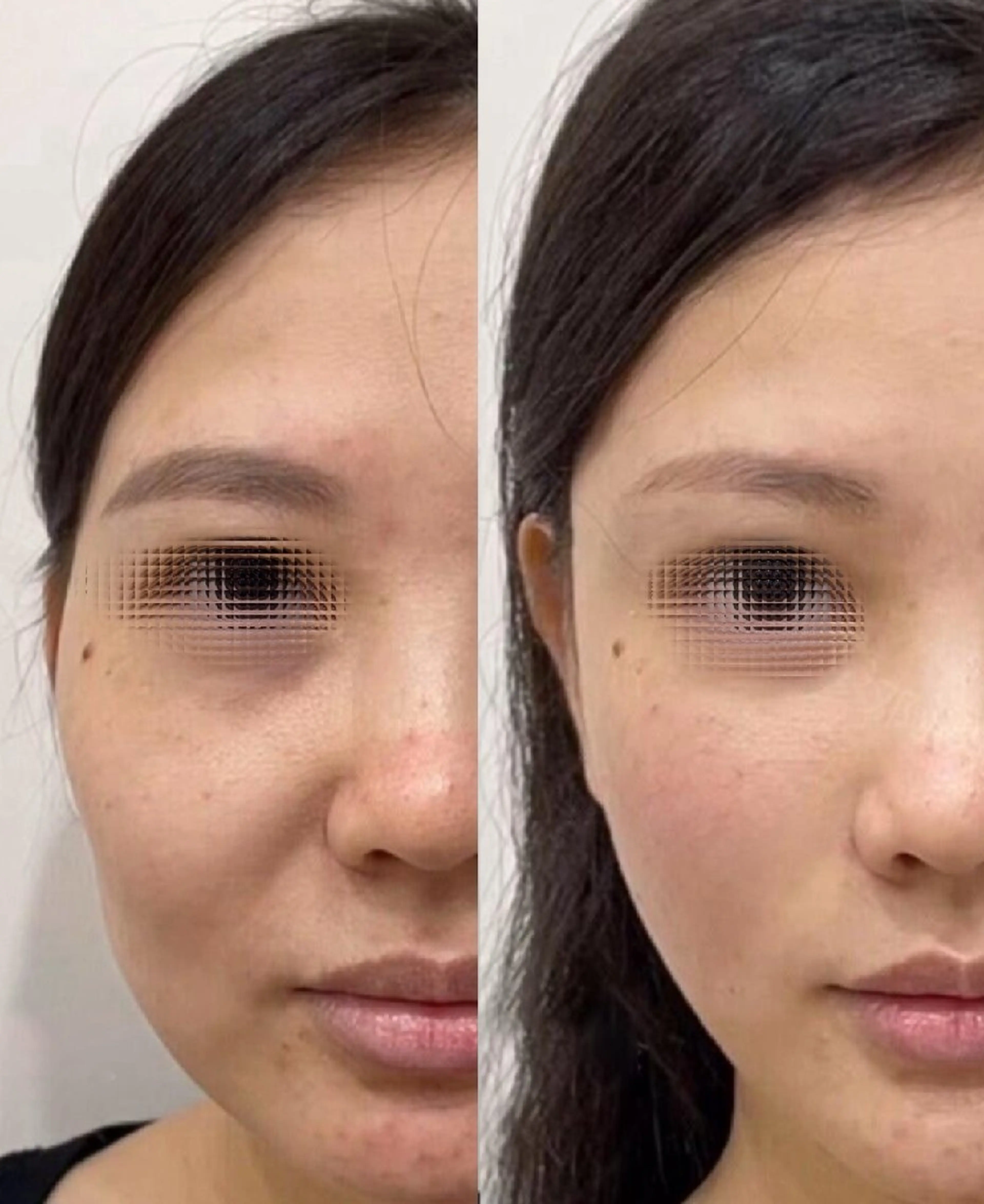 aliaハーブ水光店 エステティシャン募集のエステ・リラクイメージ