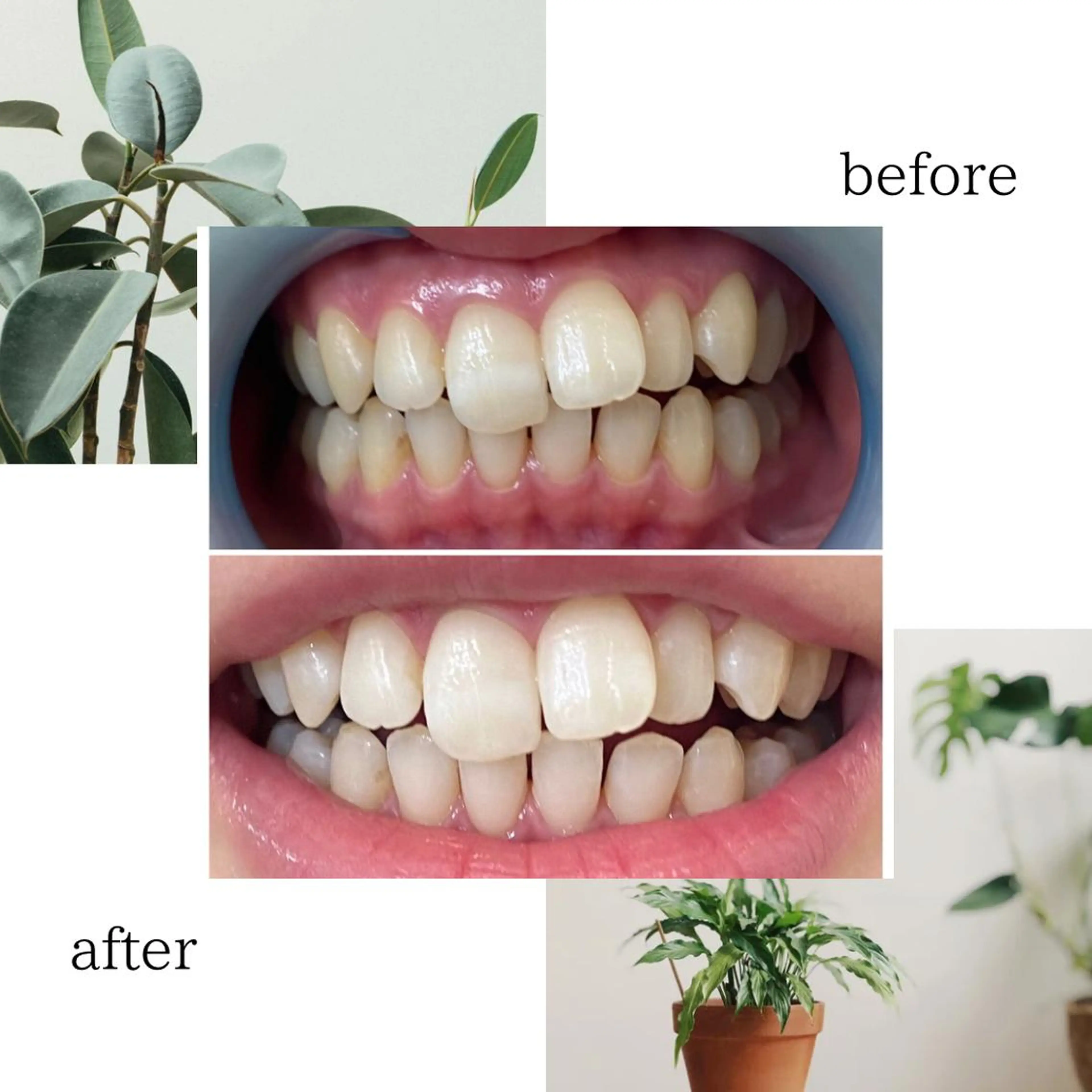 その他 脱毛専門サロンELIXIR（ｴﾘｸｻｰ）所属・脱毛&ホワイトニング ELIXIR×ULTのエステ・リラクイメージ