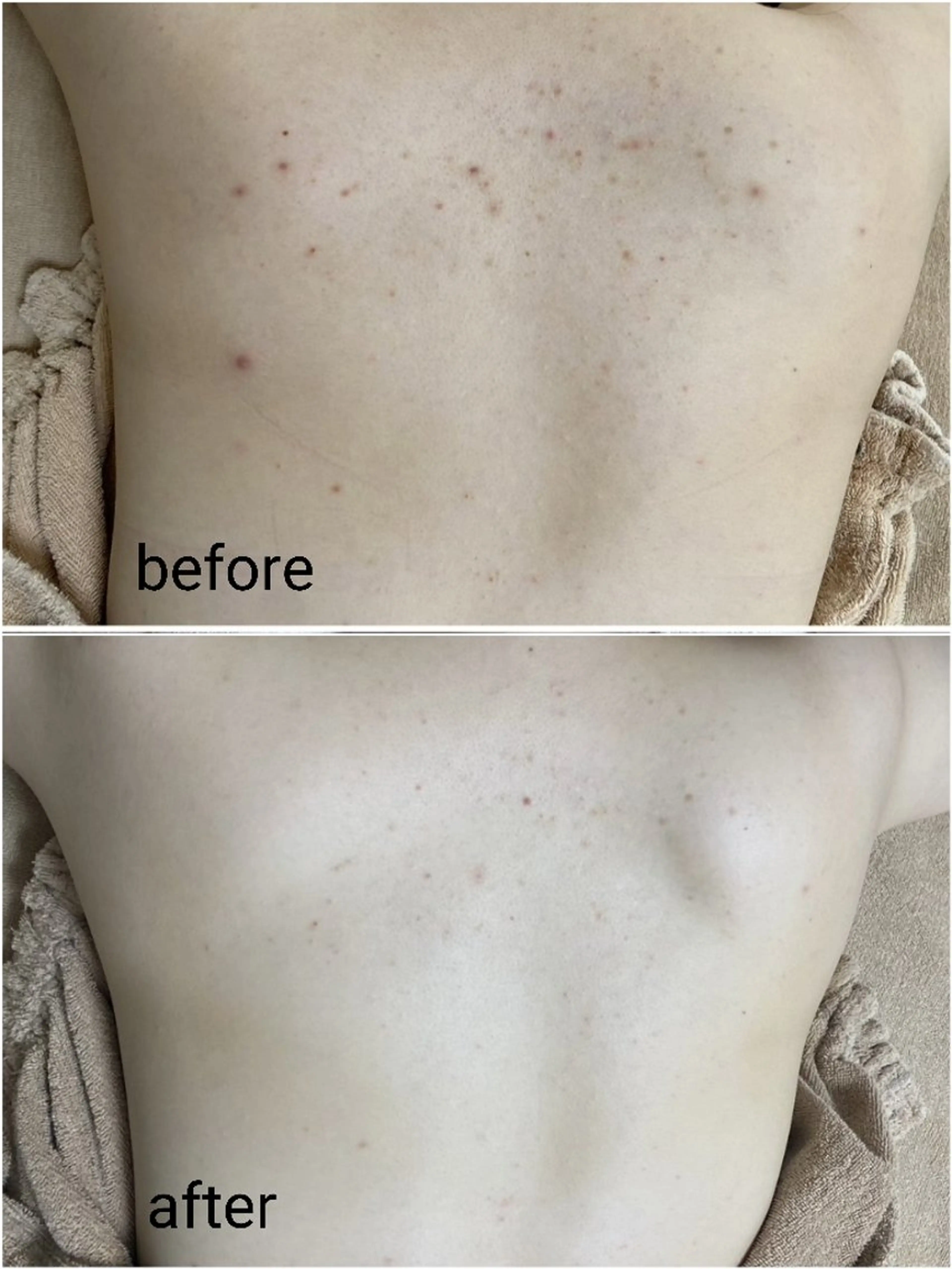 ニキビ・ニキビ跡専門 レゾン京橋店　のエステ・リラクイメージ