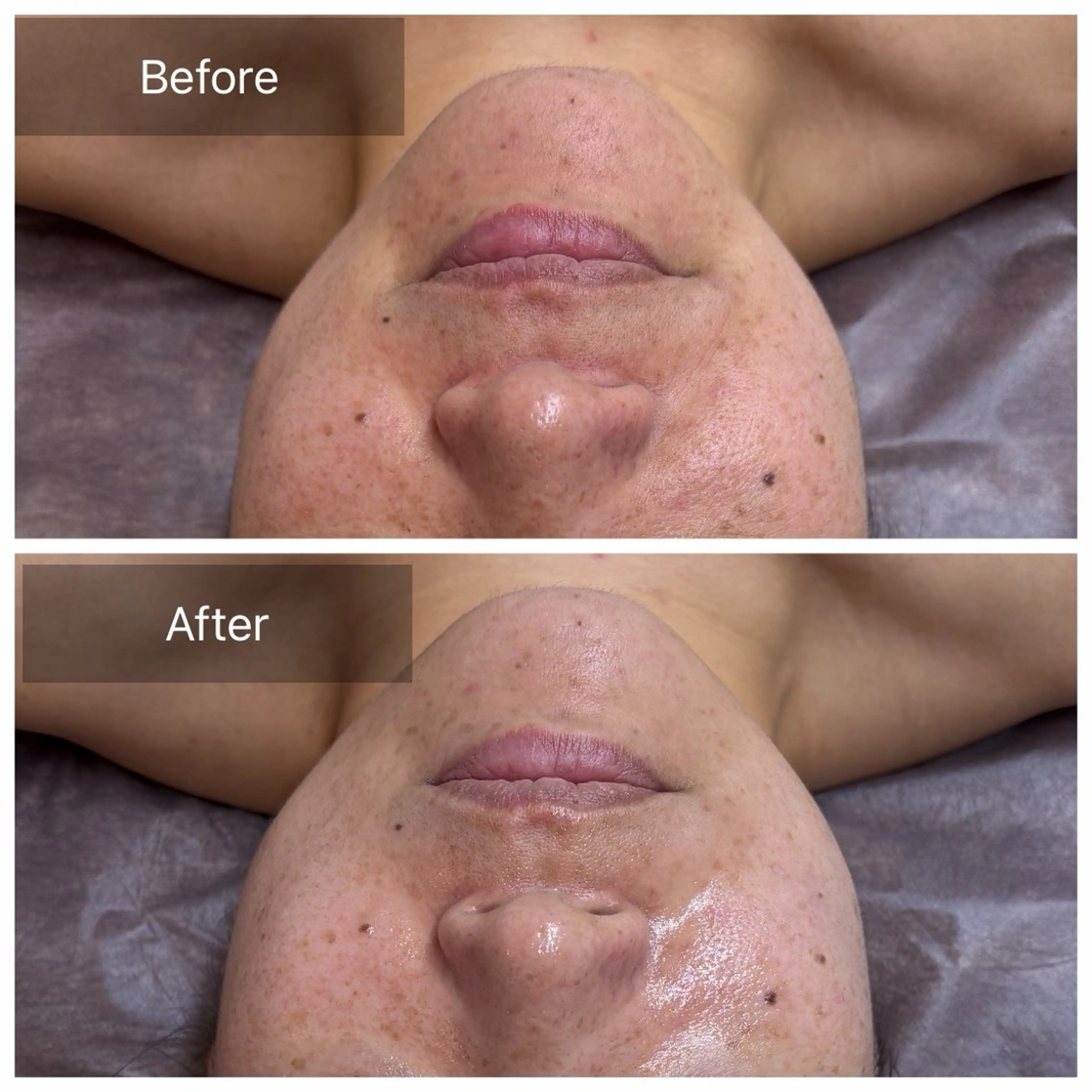 エステ コアラル恵比寿店 chiakiのエステ・リラクイメージ