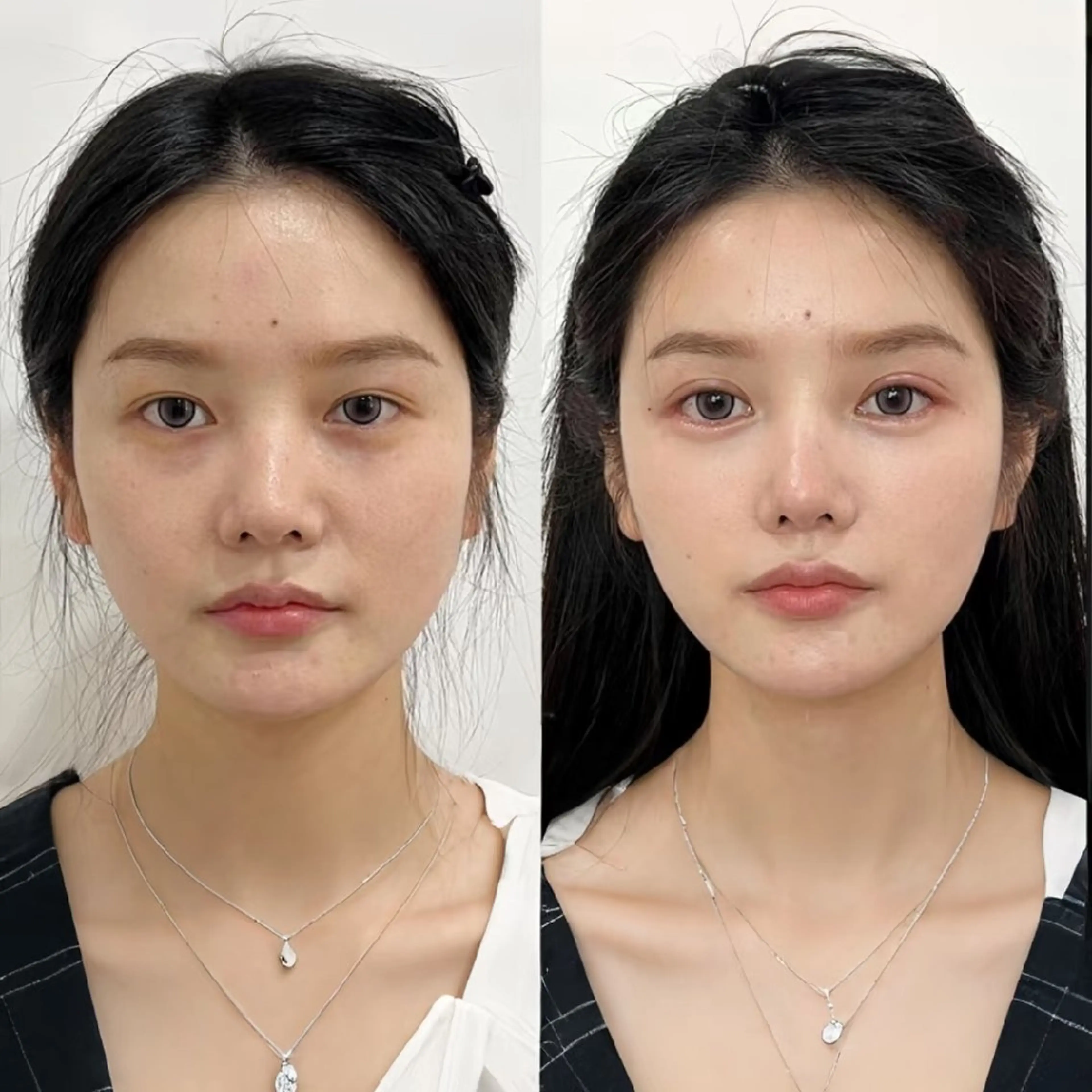 aliaハーブ水光店 エステティシャン募集のエステ・リラクイメージ