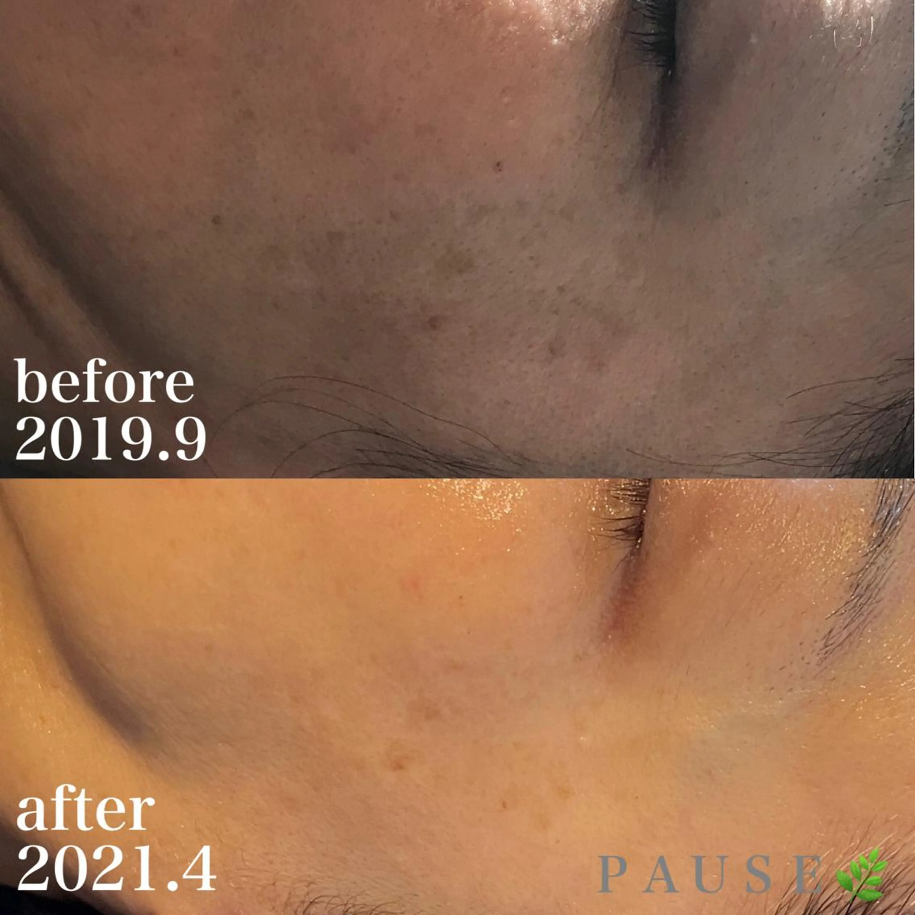 エステ 浜野 恵美のエステ・リラクイメージ