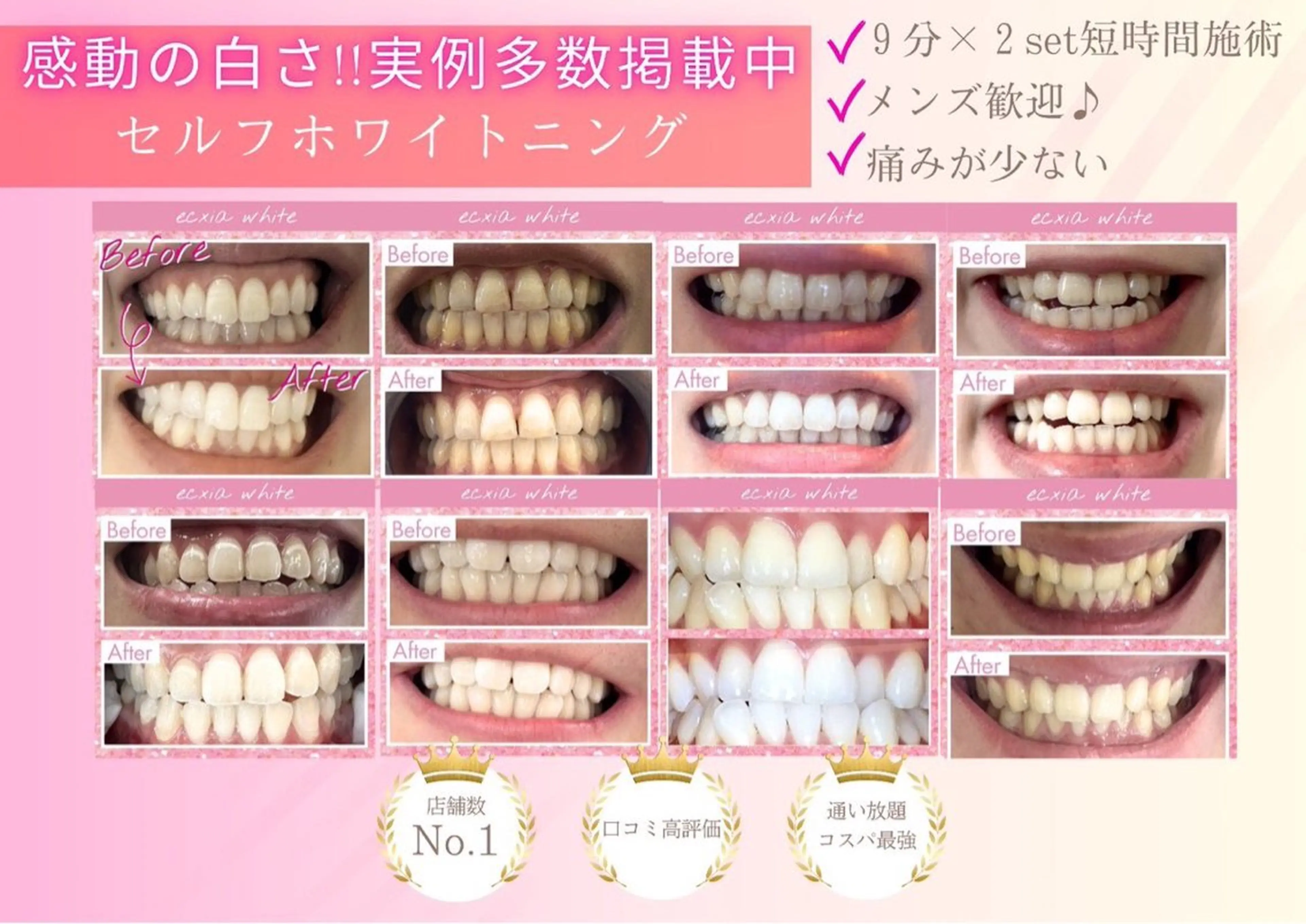 エクシアホワイト 立川南口のエステ・リラクイメージ