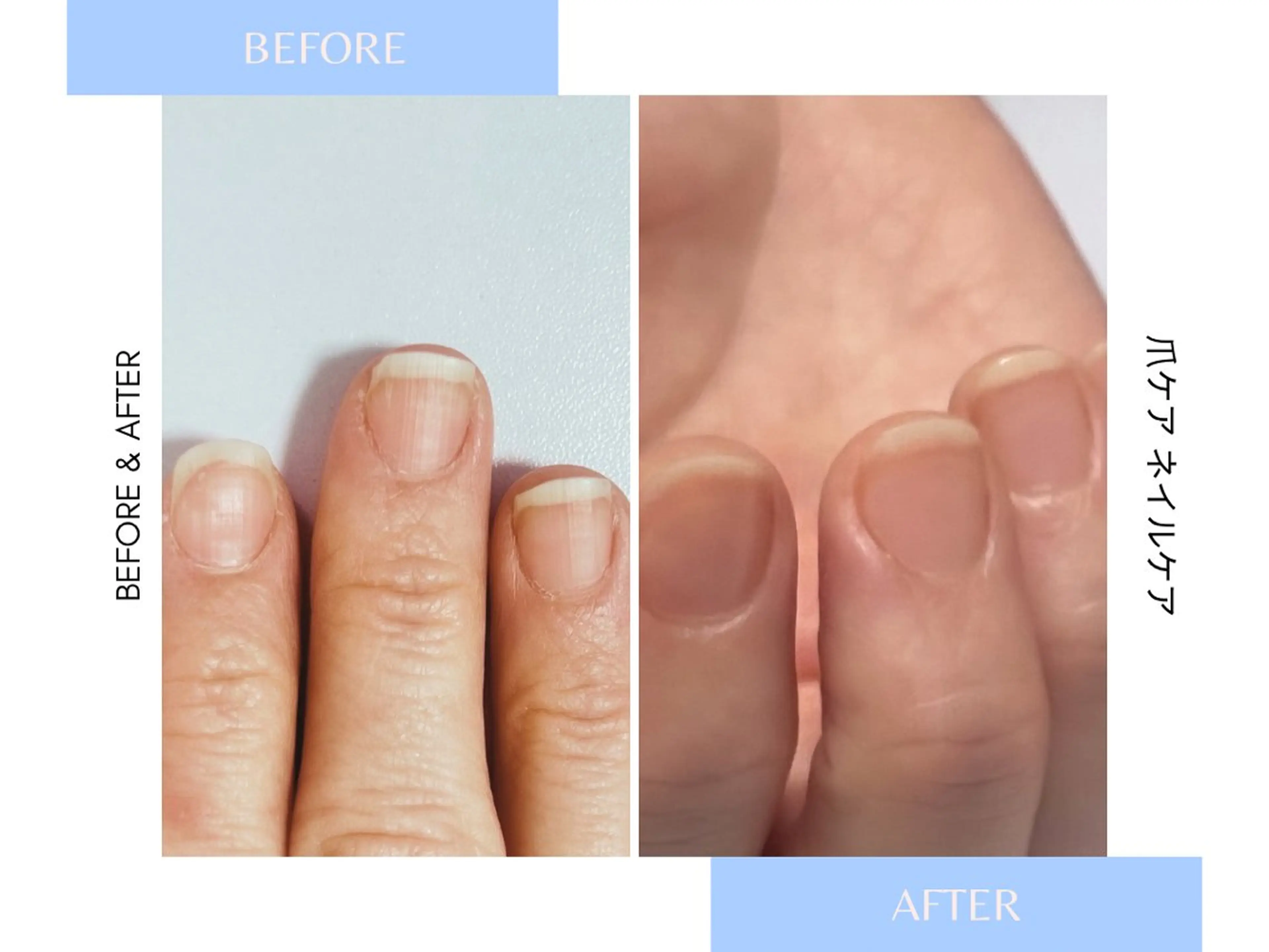 【自爪育成/当日】ジェルネイルをせずに補強(つやありorなし)🐰割れる、欠ける、二枚爪、縦線等ある方爪ケア/ネイルケアの写真