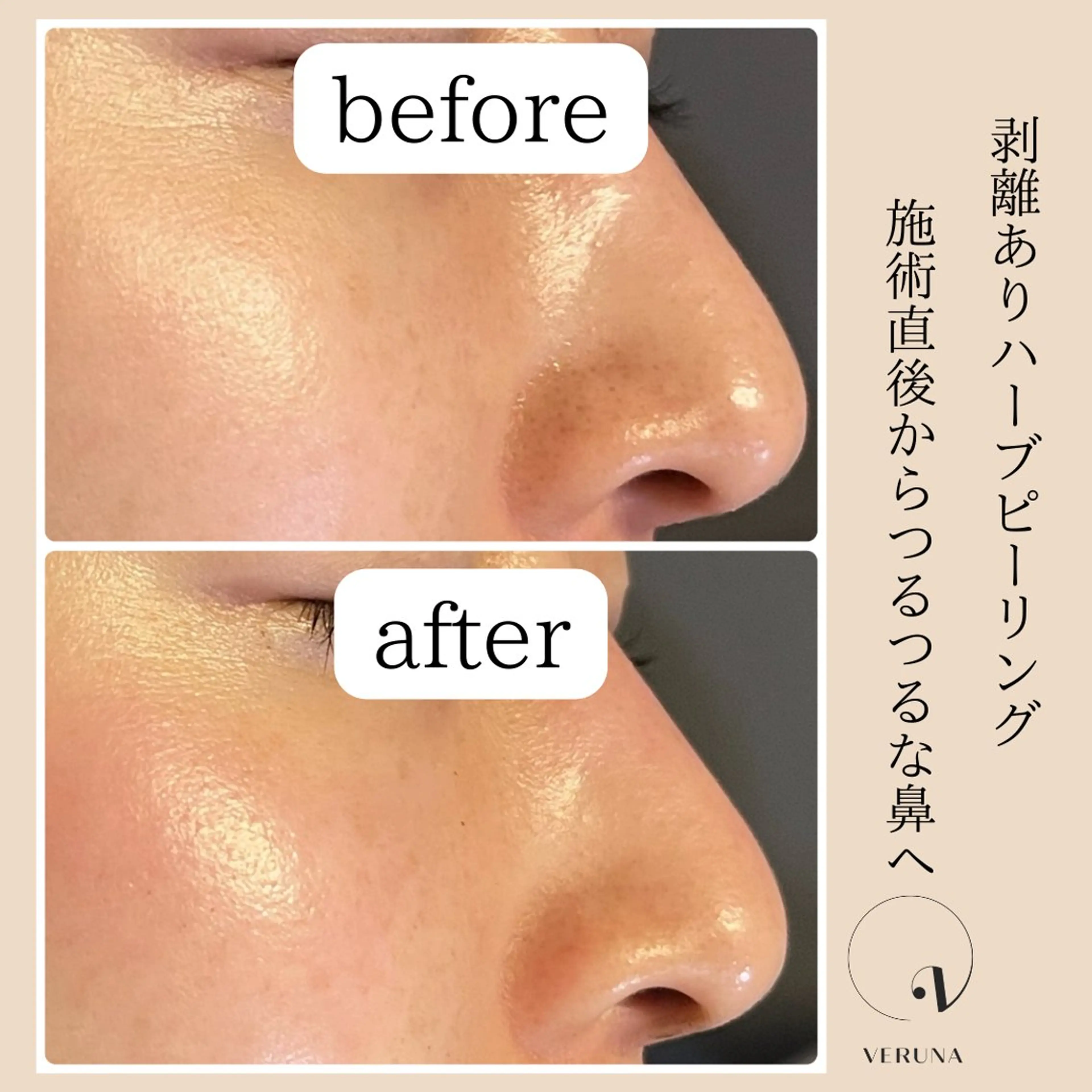 ピーリング専門店 Belluteのエステ・リラクイメージ