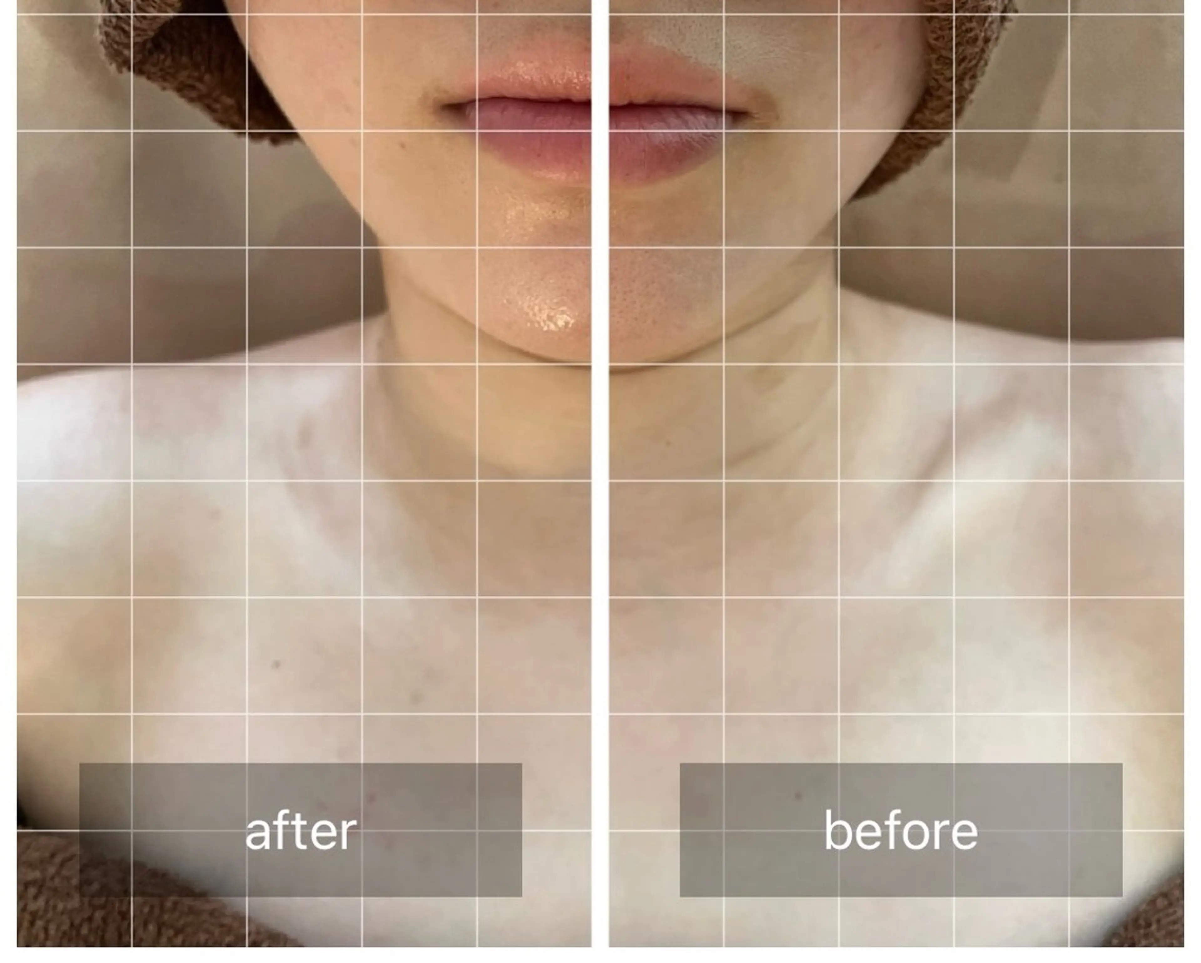 心斎橋痩身ダイエット 韓国.美容鍼.小顔のエステ・リラクイメージ