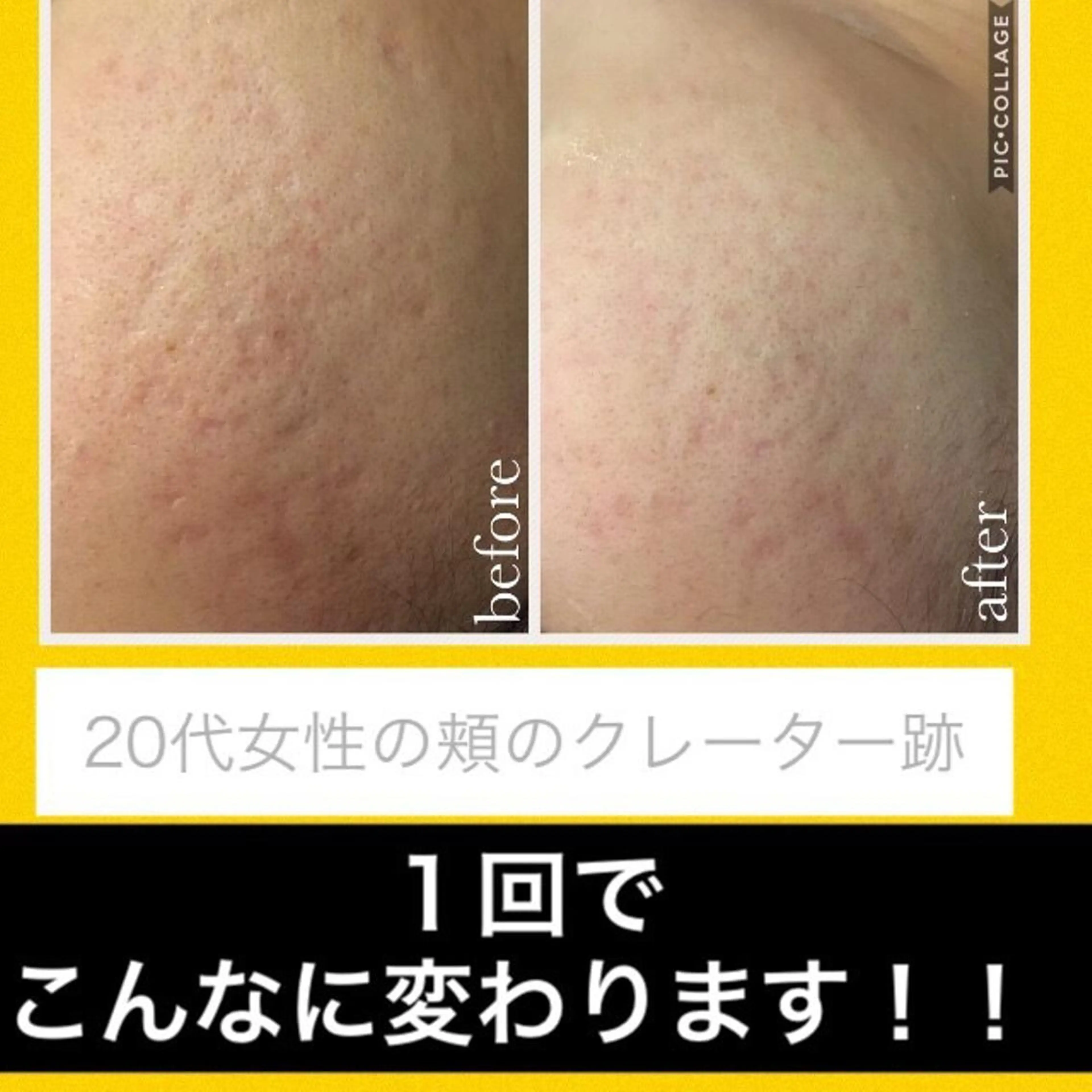 ミディアム カラー パーマ ヘアアレンジ メンズ キッズ ネイル マツエク・マツパ ニキビ・肌質改善専門 ♡人生が変わるサロンのエステ・リラクイメージ