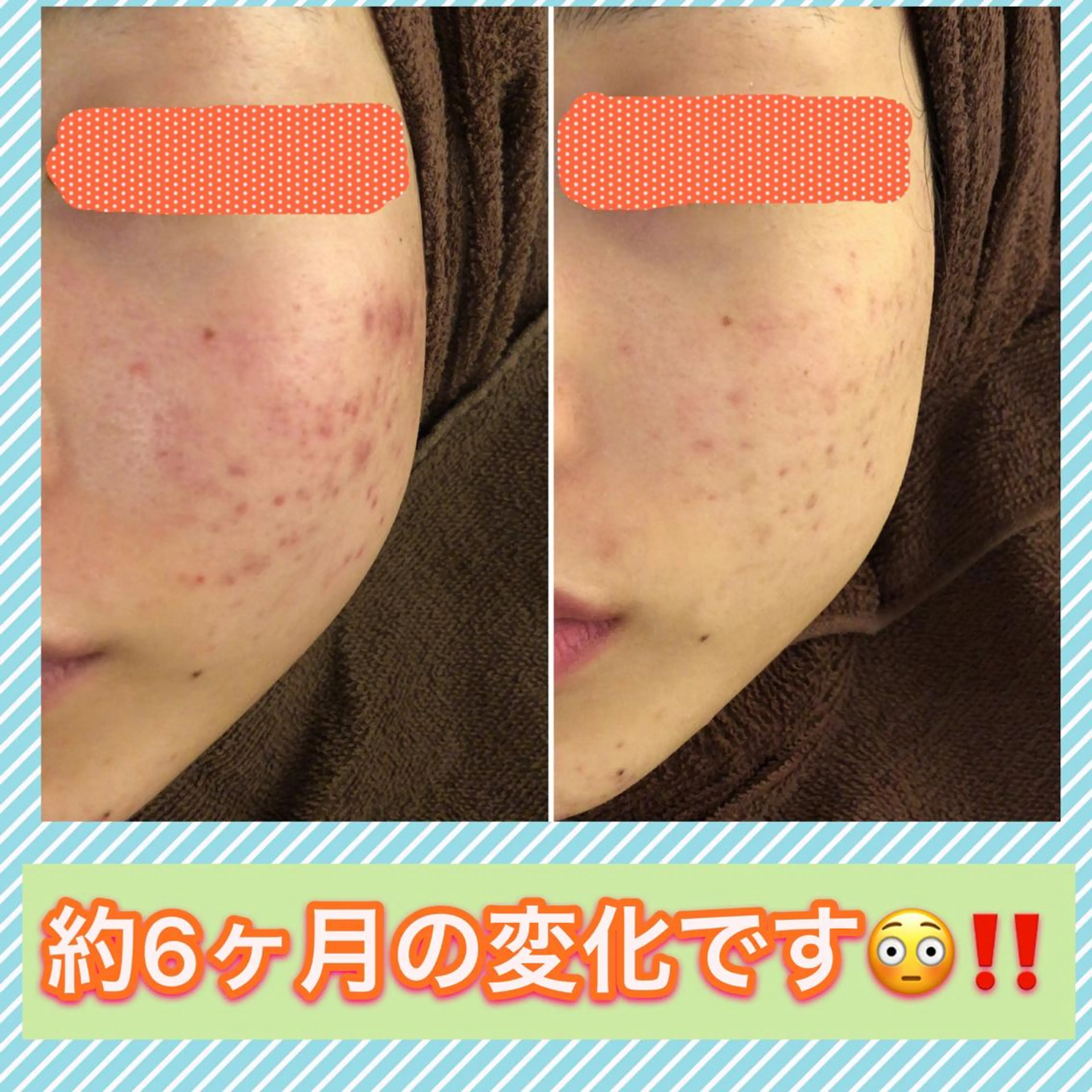 ミディアム カラー パーマ ヘアアレンジ メンズ キッズ ネイル マツエク・マツパ ニキビ・肌質改善専門 ♡人生が変わるサロンのエステ・リラクイメージ