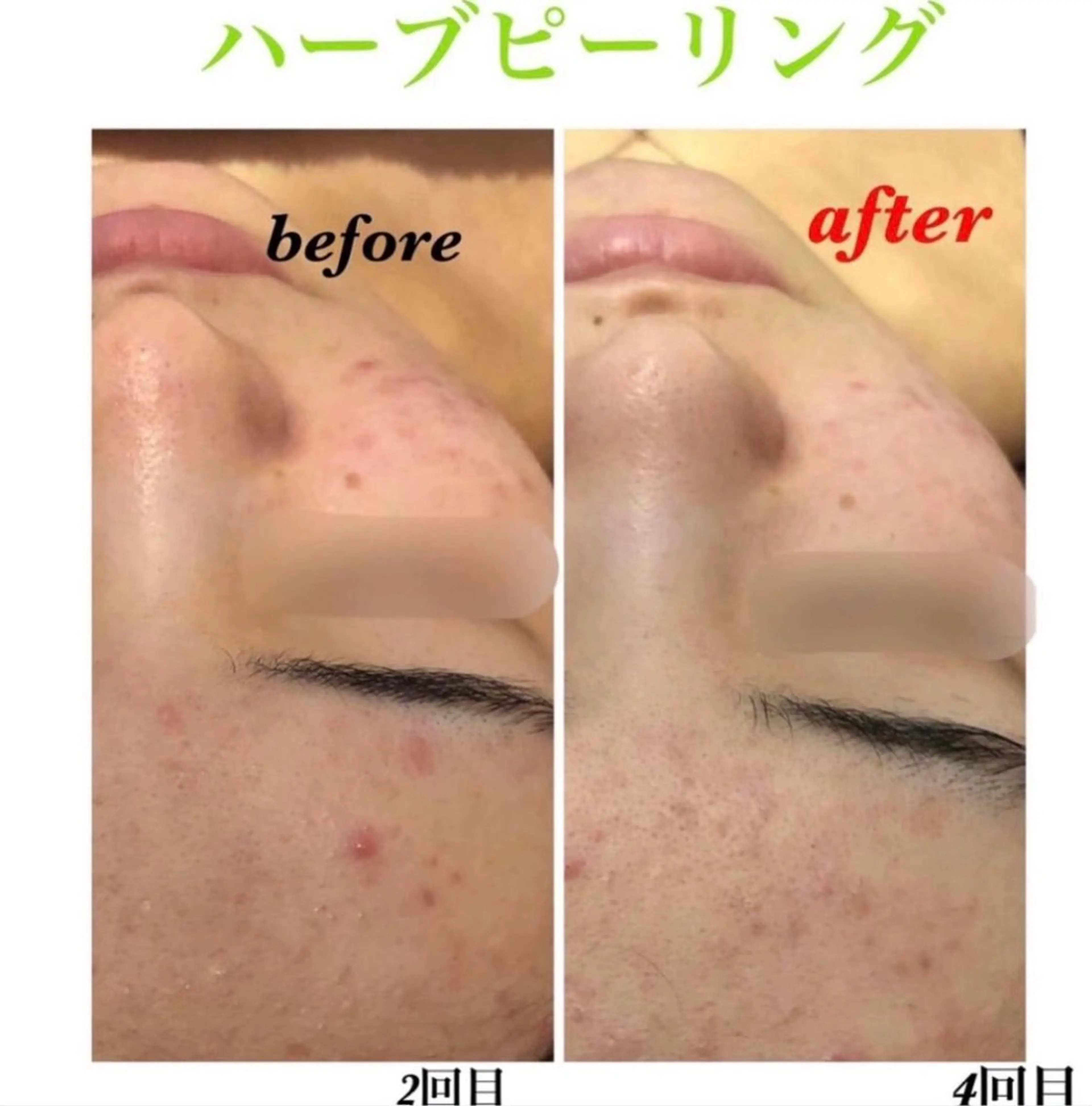 エステ The Esthe .赤坂店のエステ・リラクイメージ