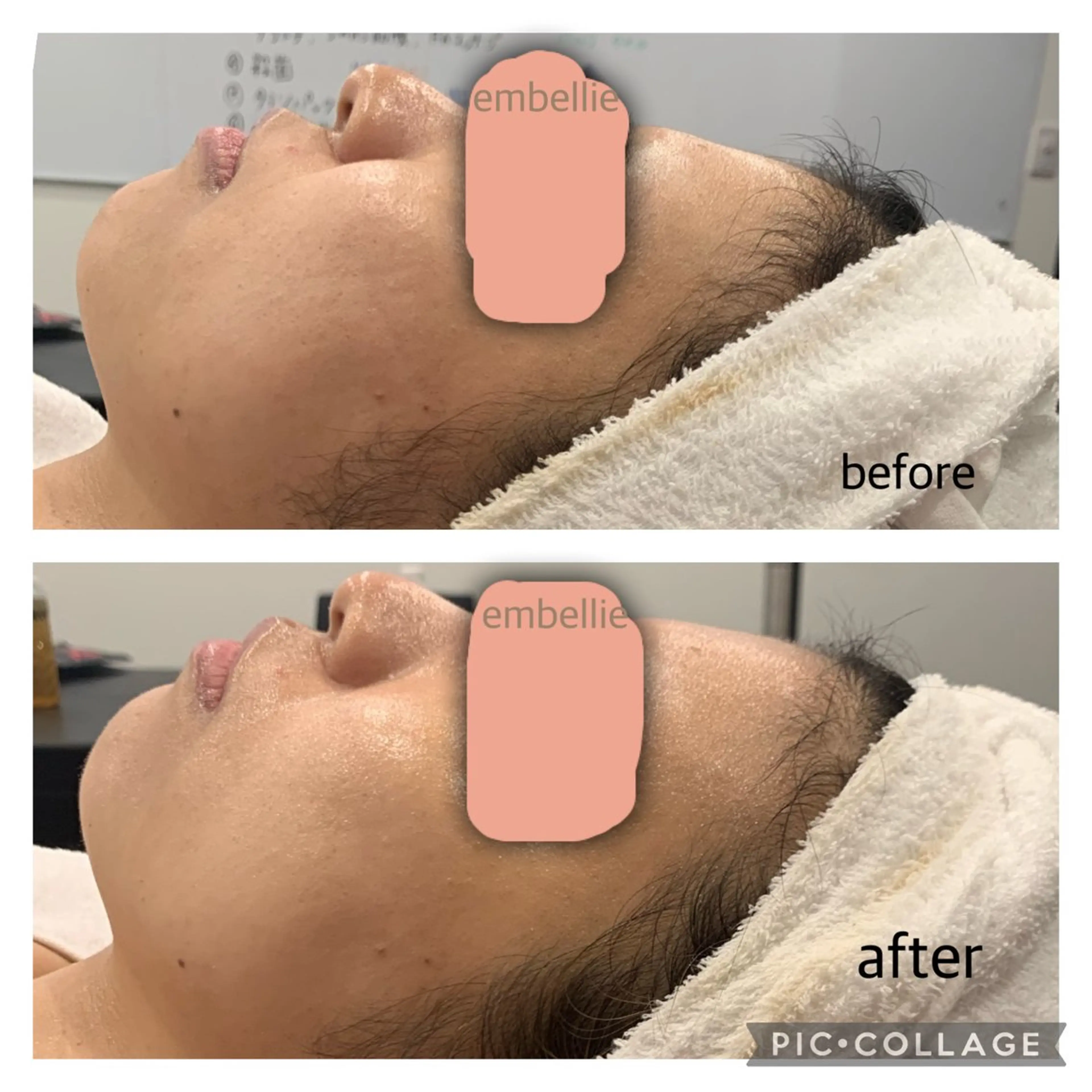 エステ miyasaka erikoのネイルデザイン