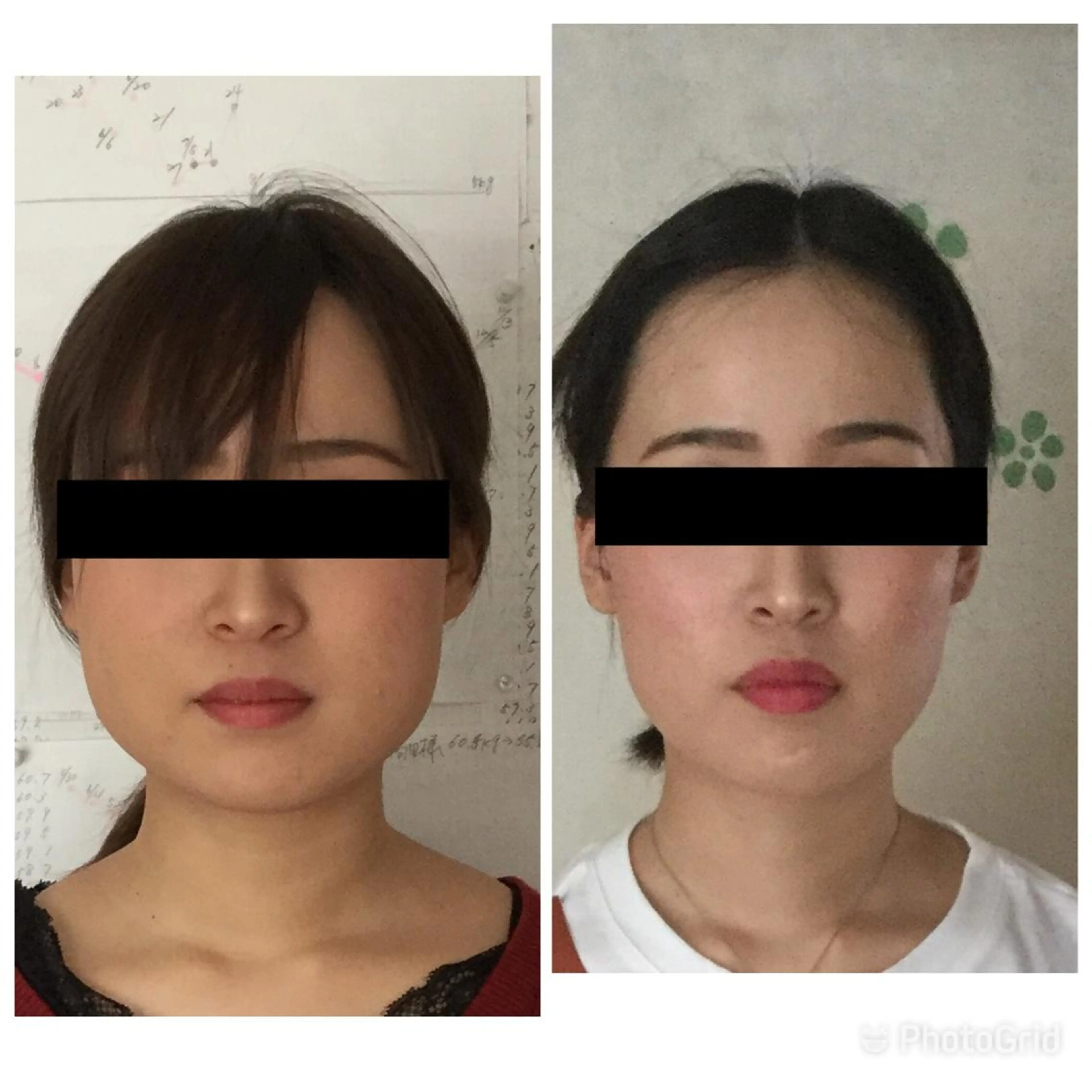 【新規】【ソフトタッチ&長持ち小顔矯正】エンドリングフェイシャル60分の写真