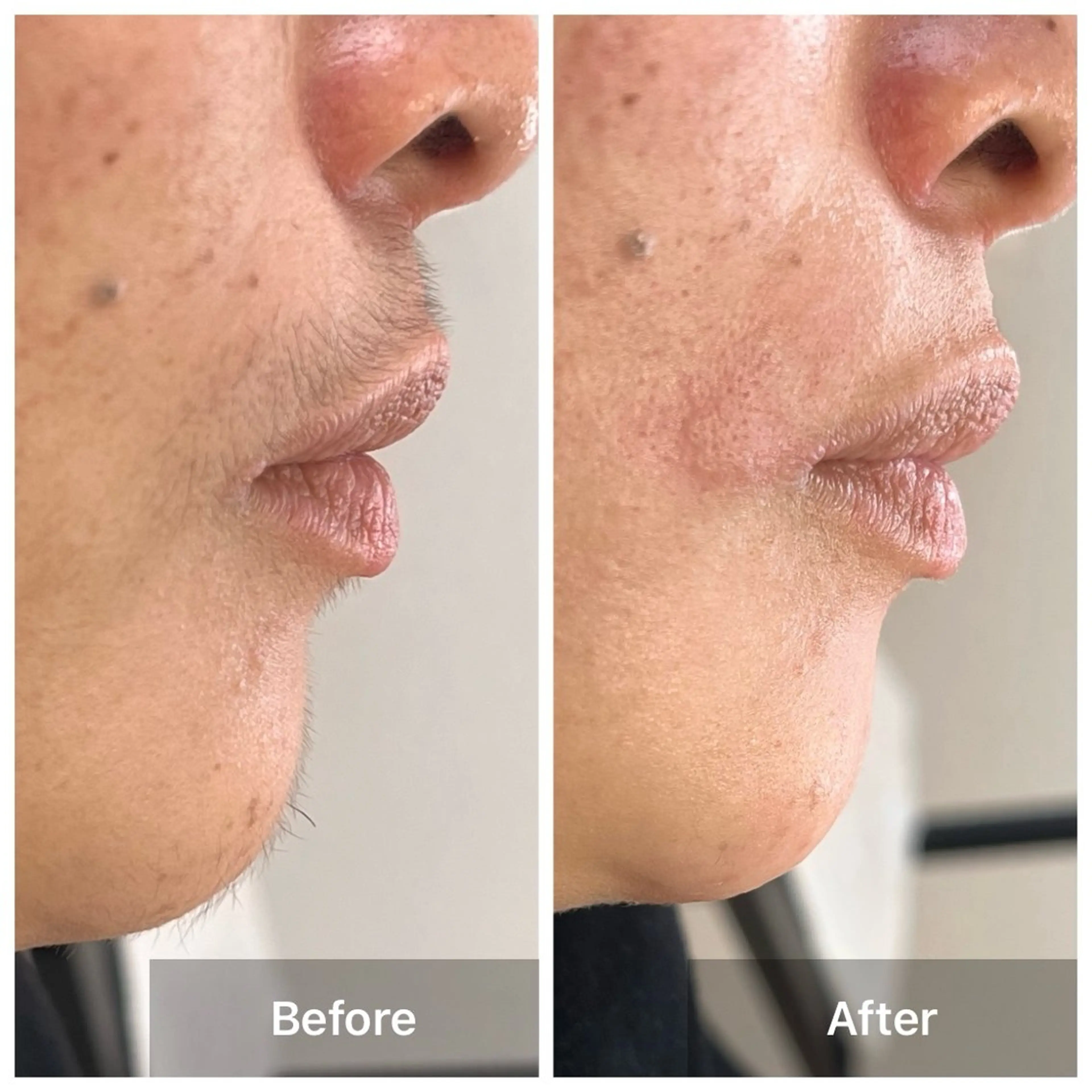 エステ LUNA / Sakikoの眉毛・アイブロウイメージ