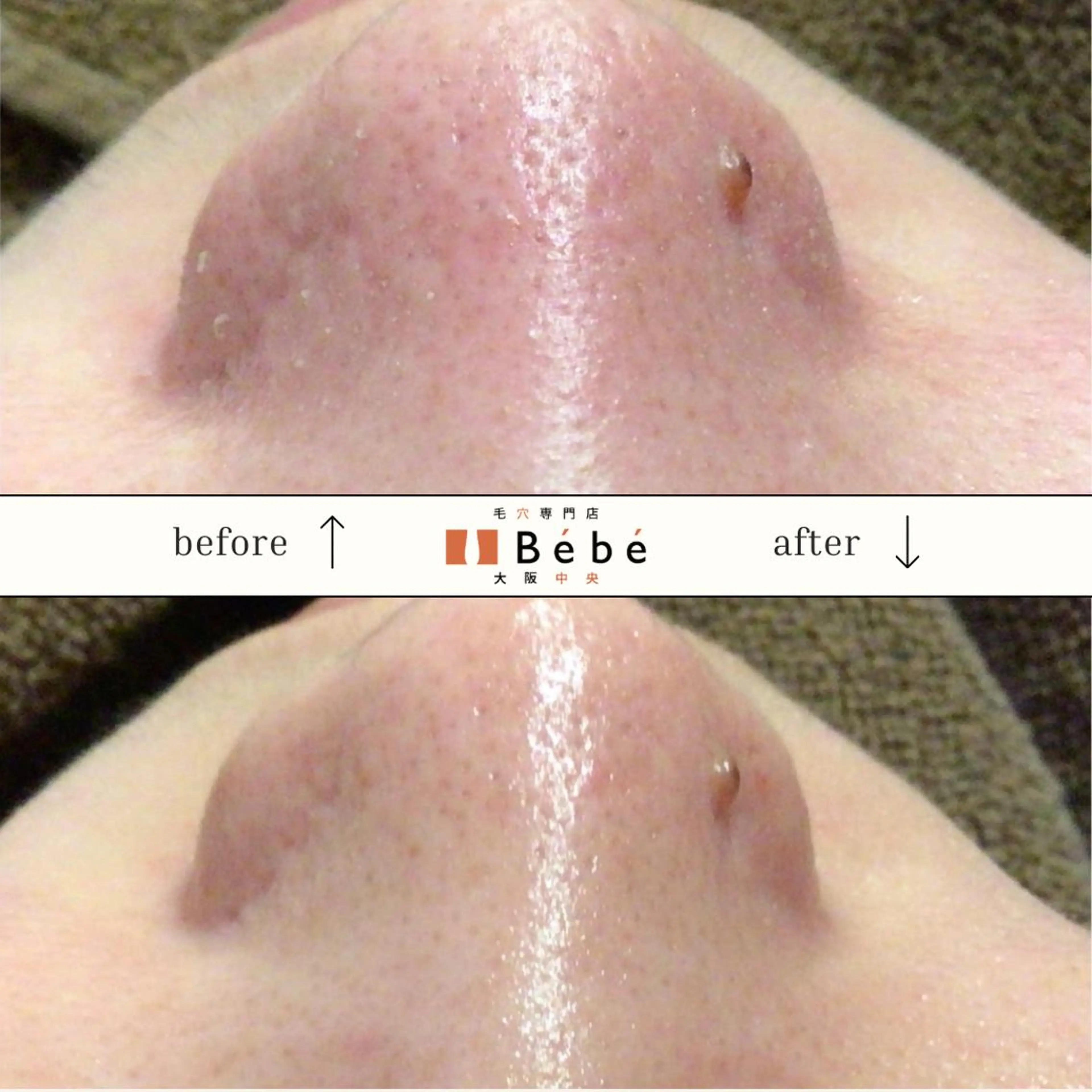 毛穴専門店Bébé 大阪中央店のエステ・リラクイメージ