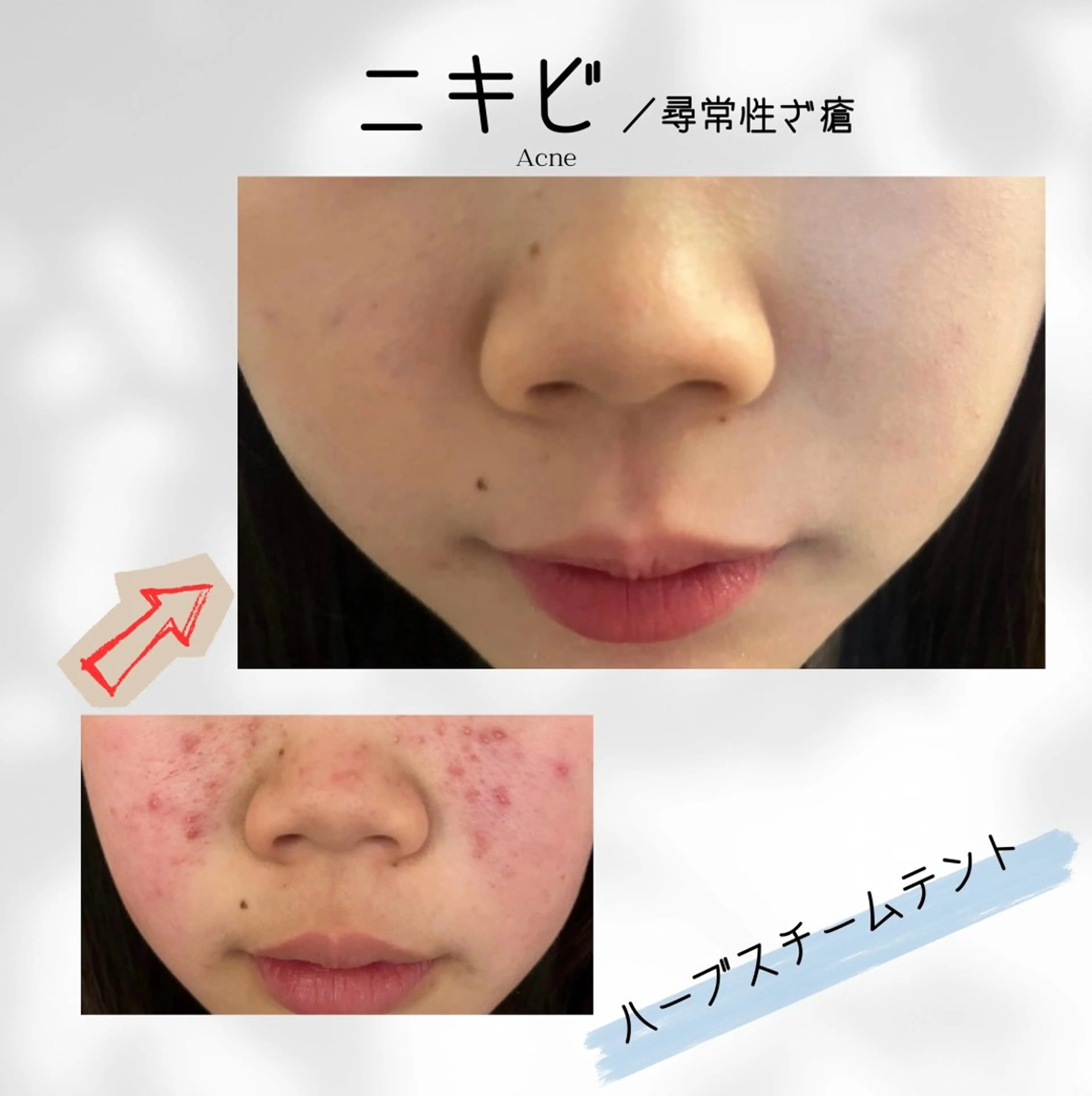 エステ リラク 体質改善✨美肌育サロ ン　香嬉琉🌿きよかのエステ・リラクイメージ