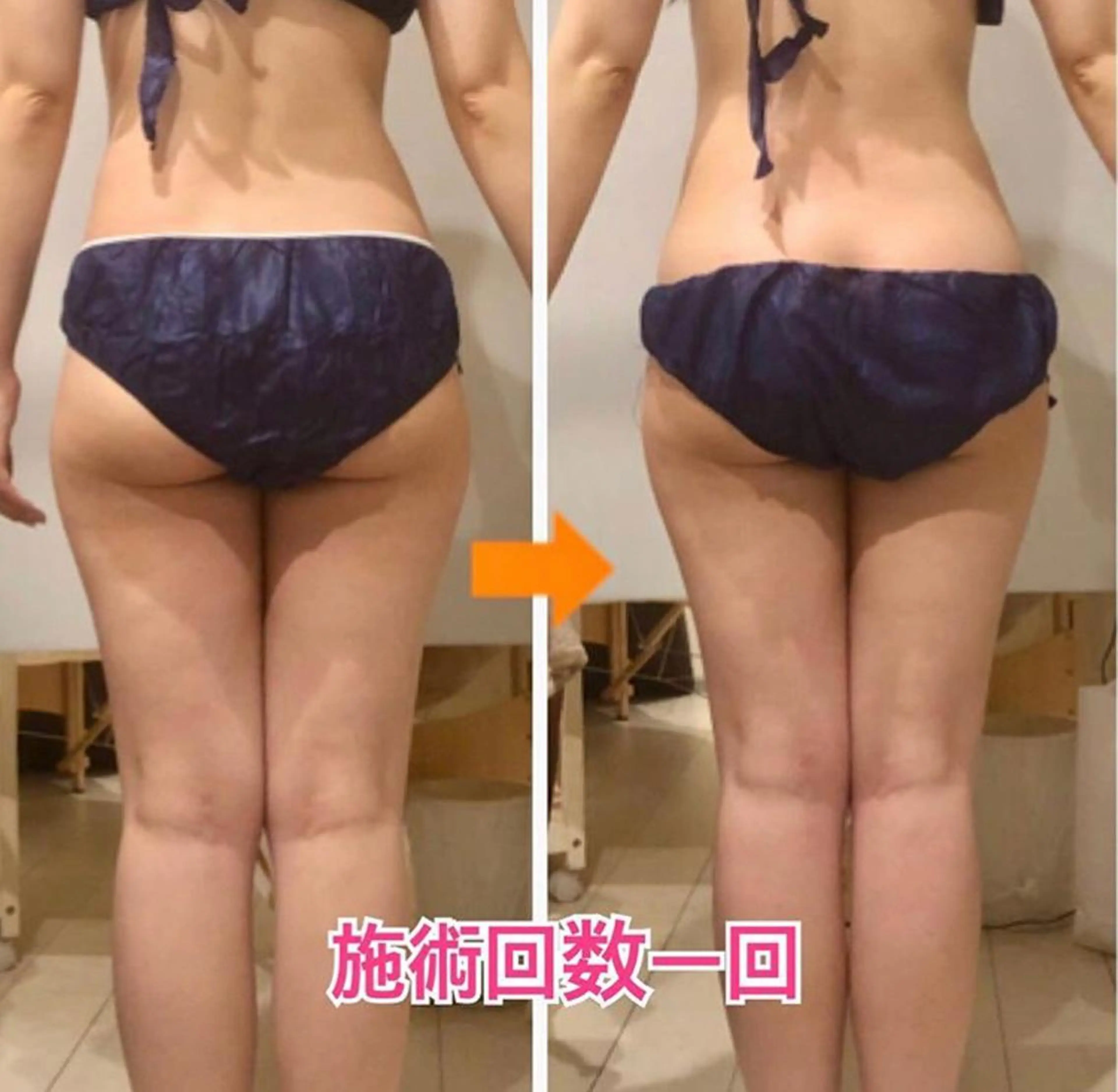 ロング カラー パーマ ヘアアレンジ メンズ キッズ ネイル マツエク・マツパ ‍痩身＆ボディ 結果出し🌟丹野のエステ・リラクイメージ