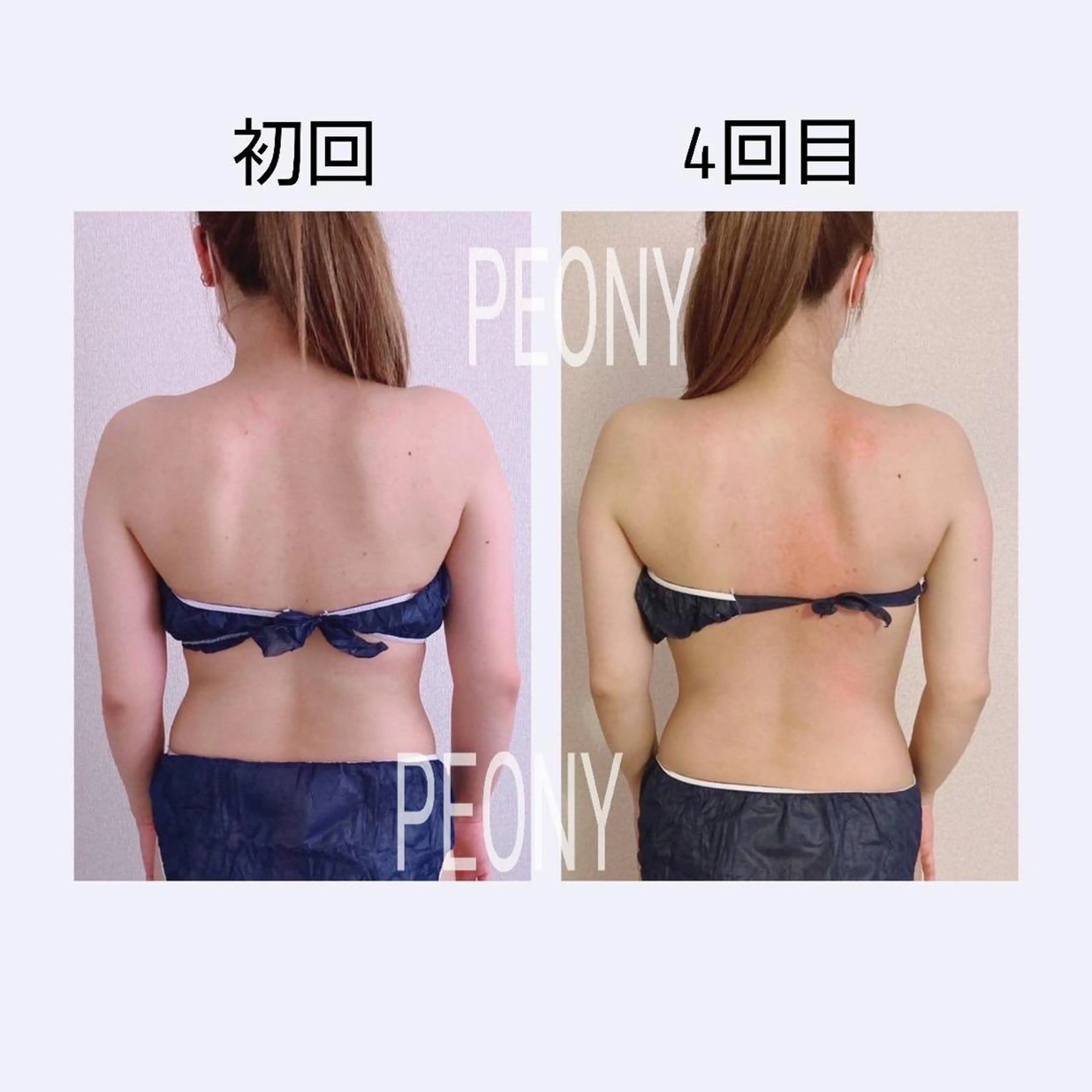 デトックス美容専門 サロンｐｅｏｎｙのエステ・リラクイメージ