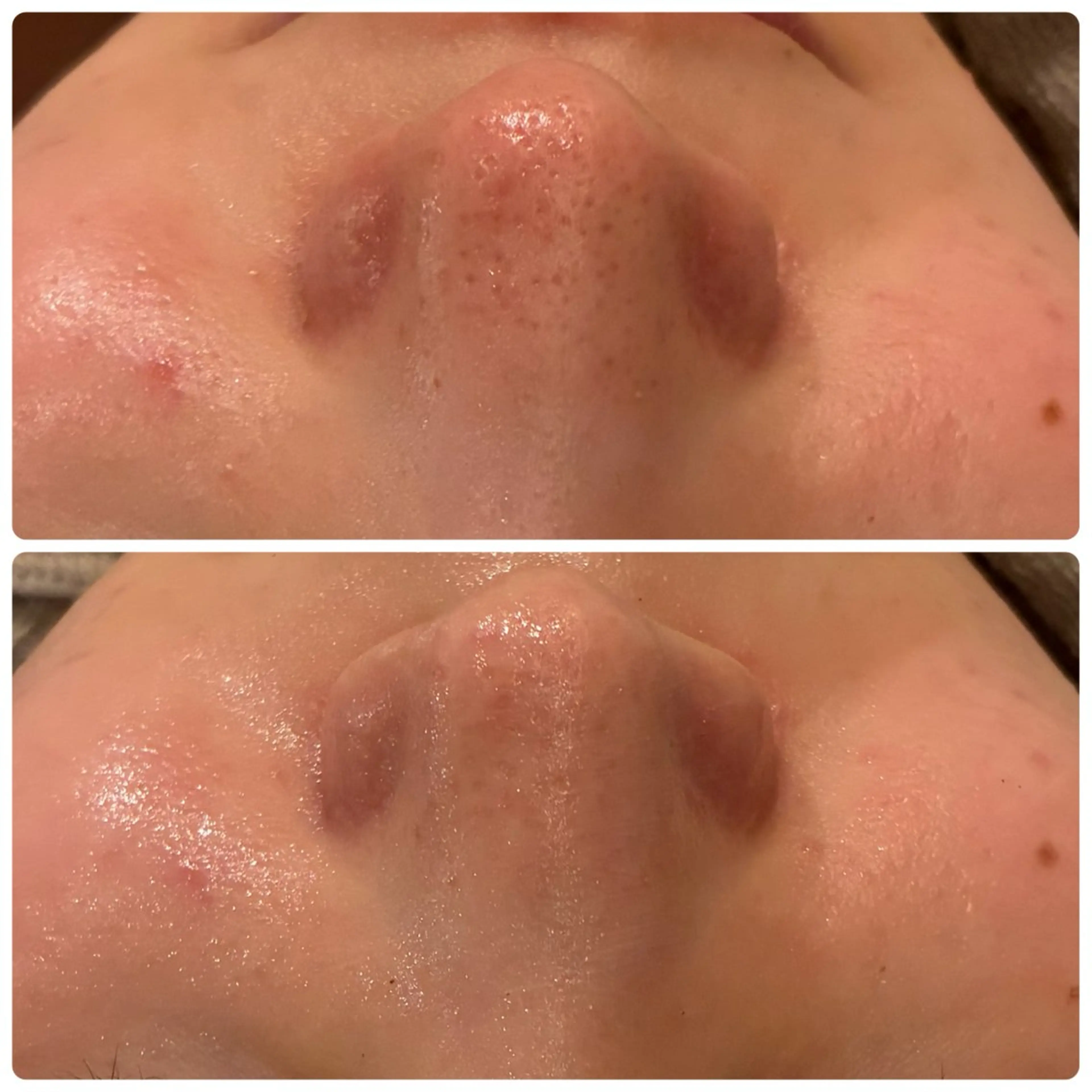 その他 yellow.所属・yellow💛【 脱毛&フェイシャル】のエステ・リラクイメージ