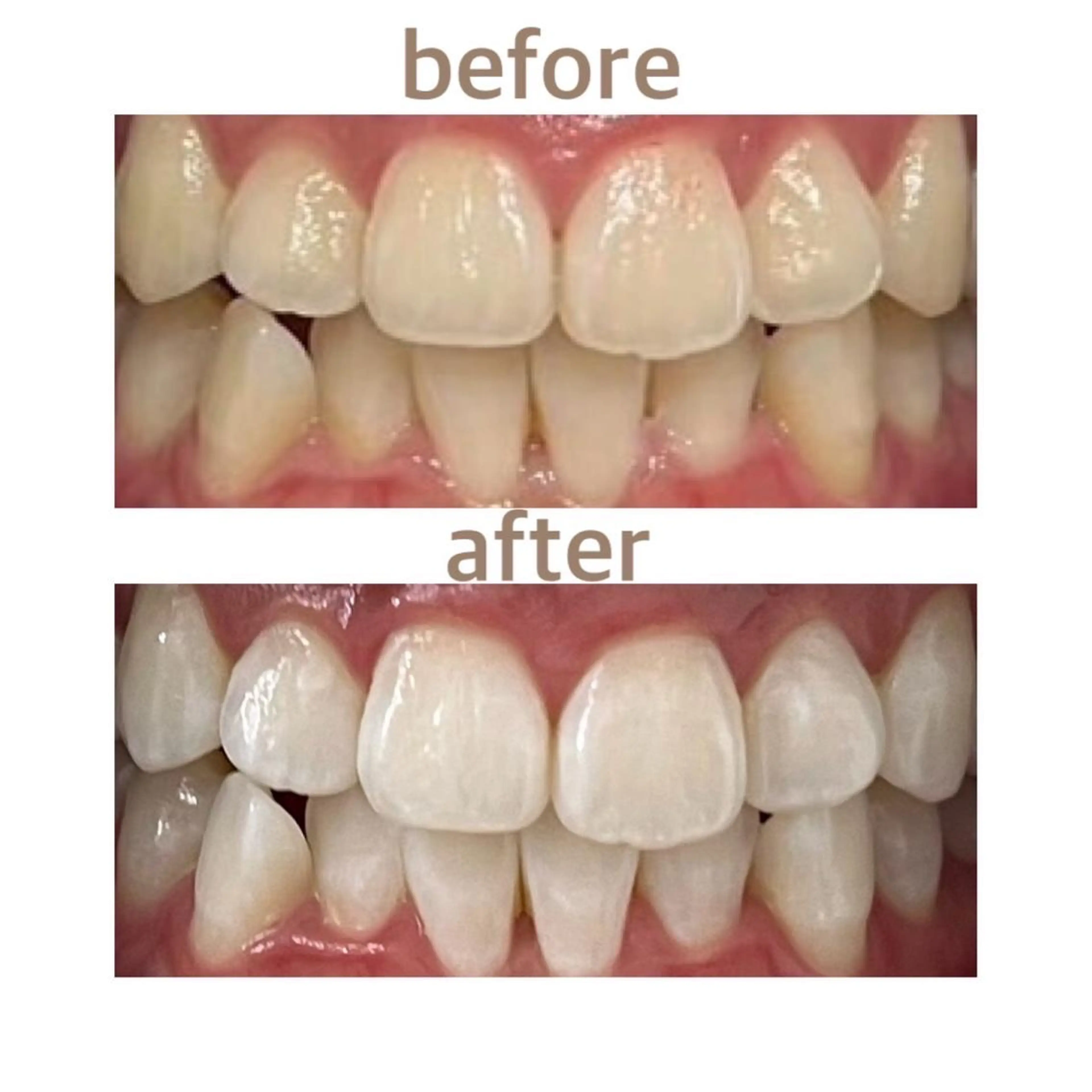 メンズ エステ リラク ホワイトニング ショップ船橋店🦷のエステ・リラクイメージ