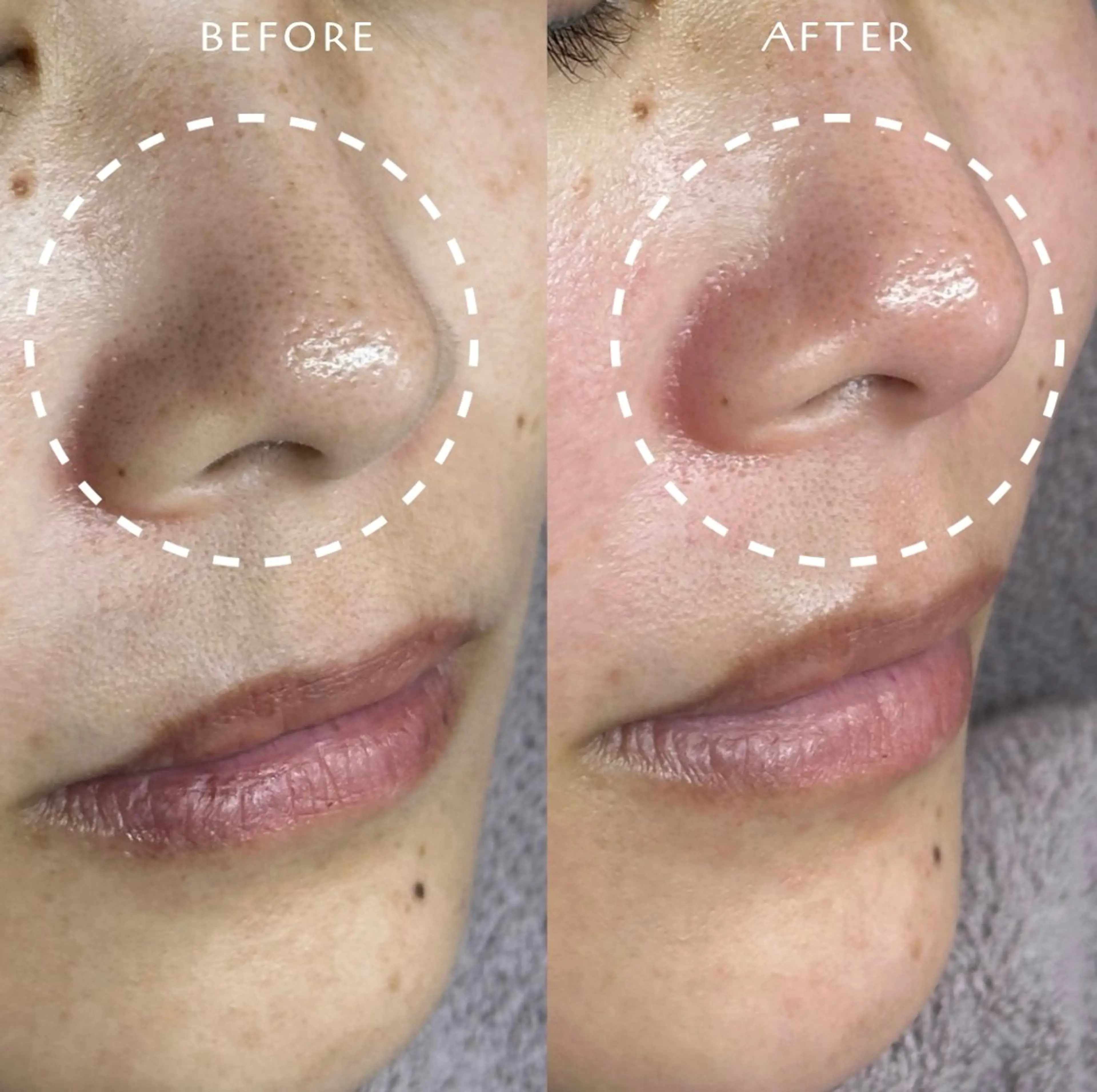 脱毛 フェイシャルワックス KANAKOのエステ・リラクイメージ