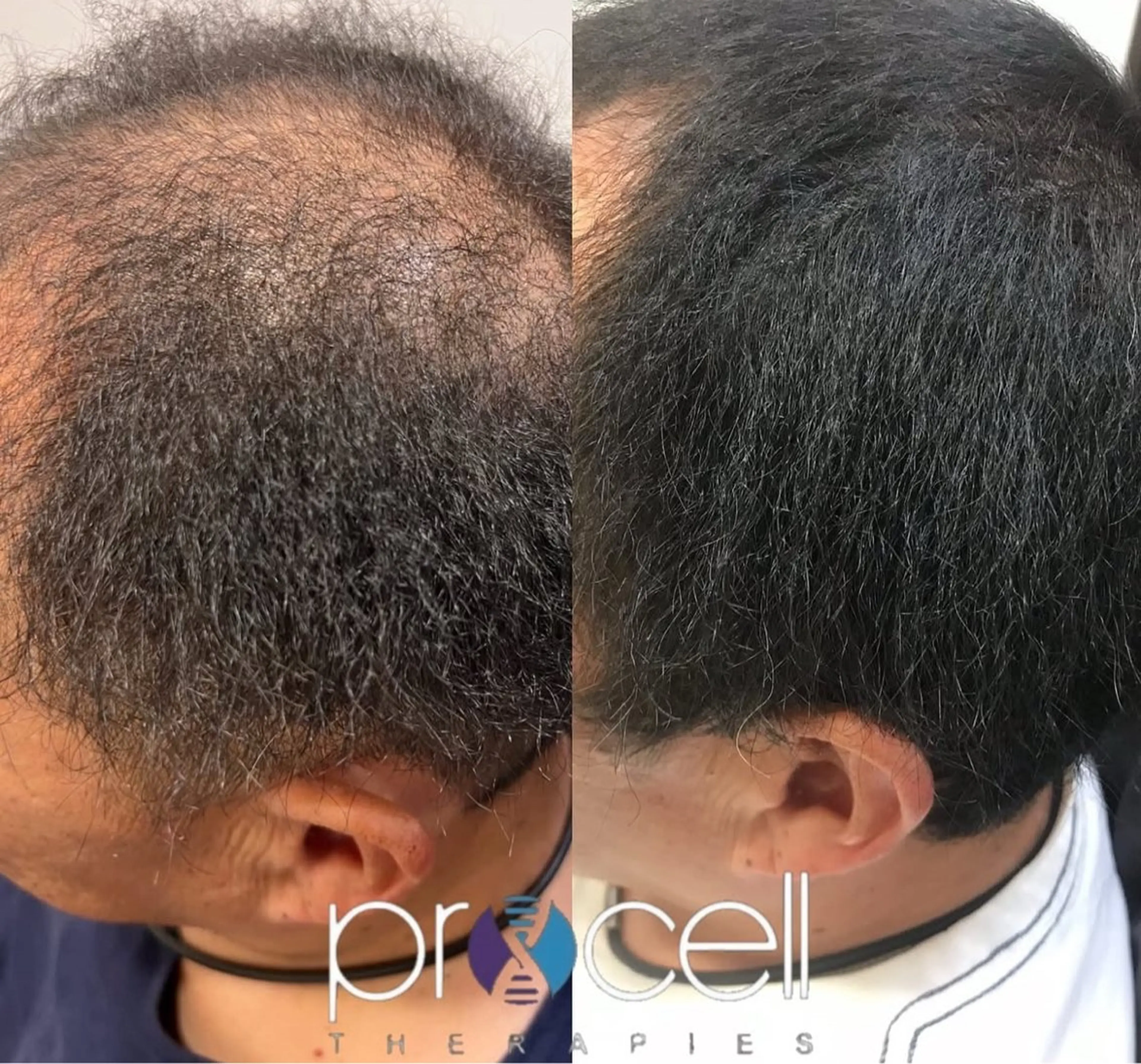 メンズ LOUISE. ／肌質・頭皮のエステ・リラクイメージ