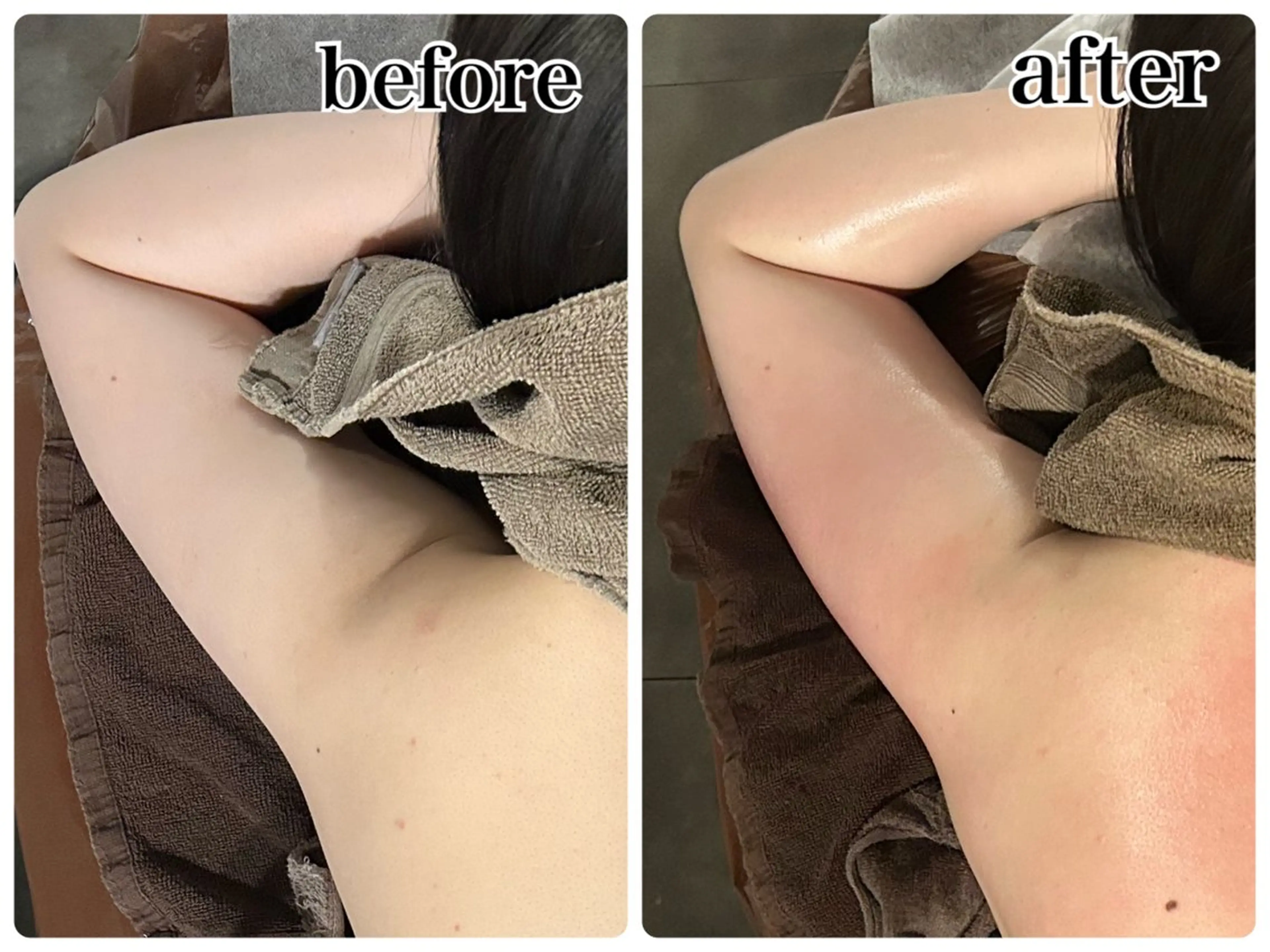 その他 Gemini MIKIのエステ・リラクイメージ