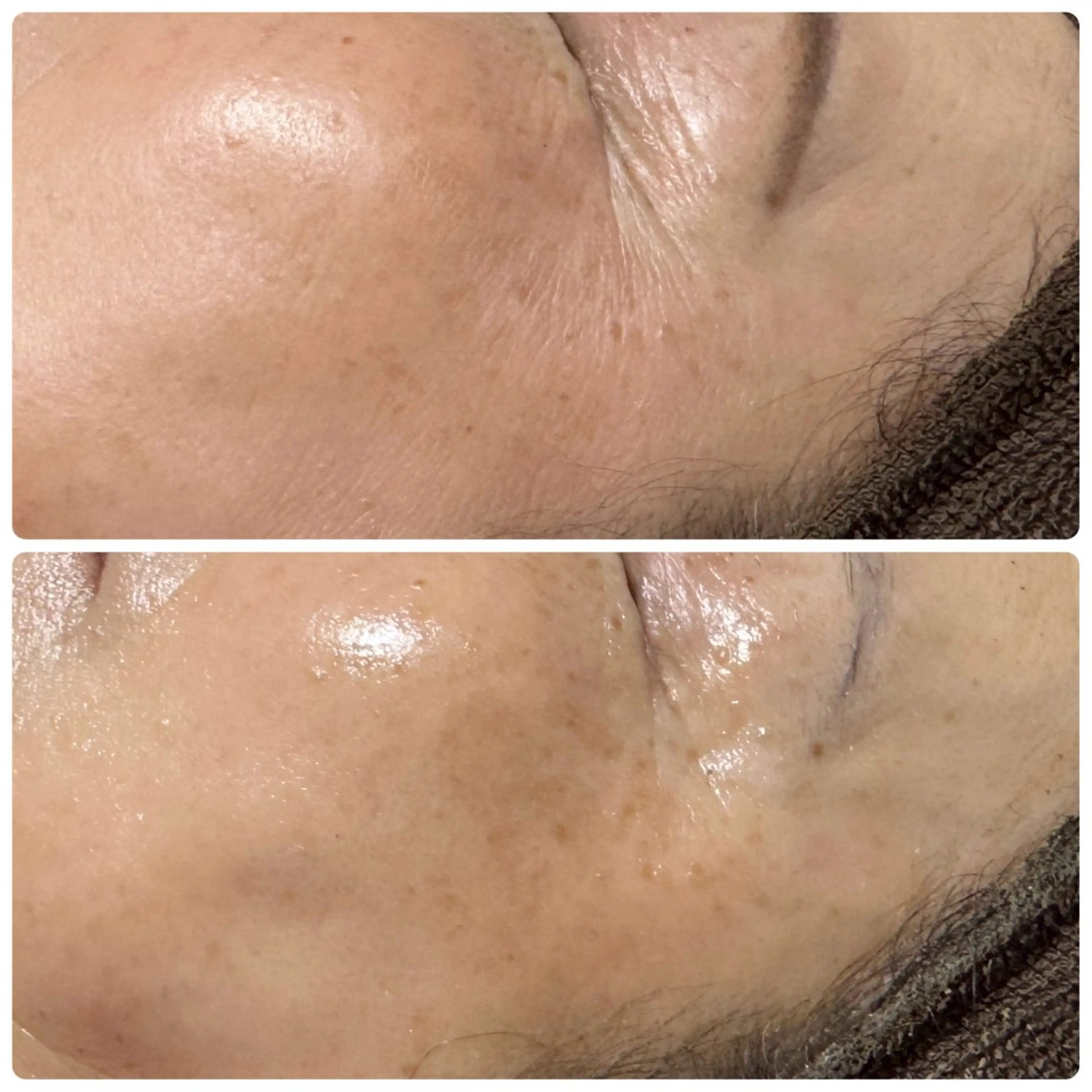 エステ 肌育脱毛サロン LikoLinaのその他イメージ